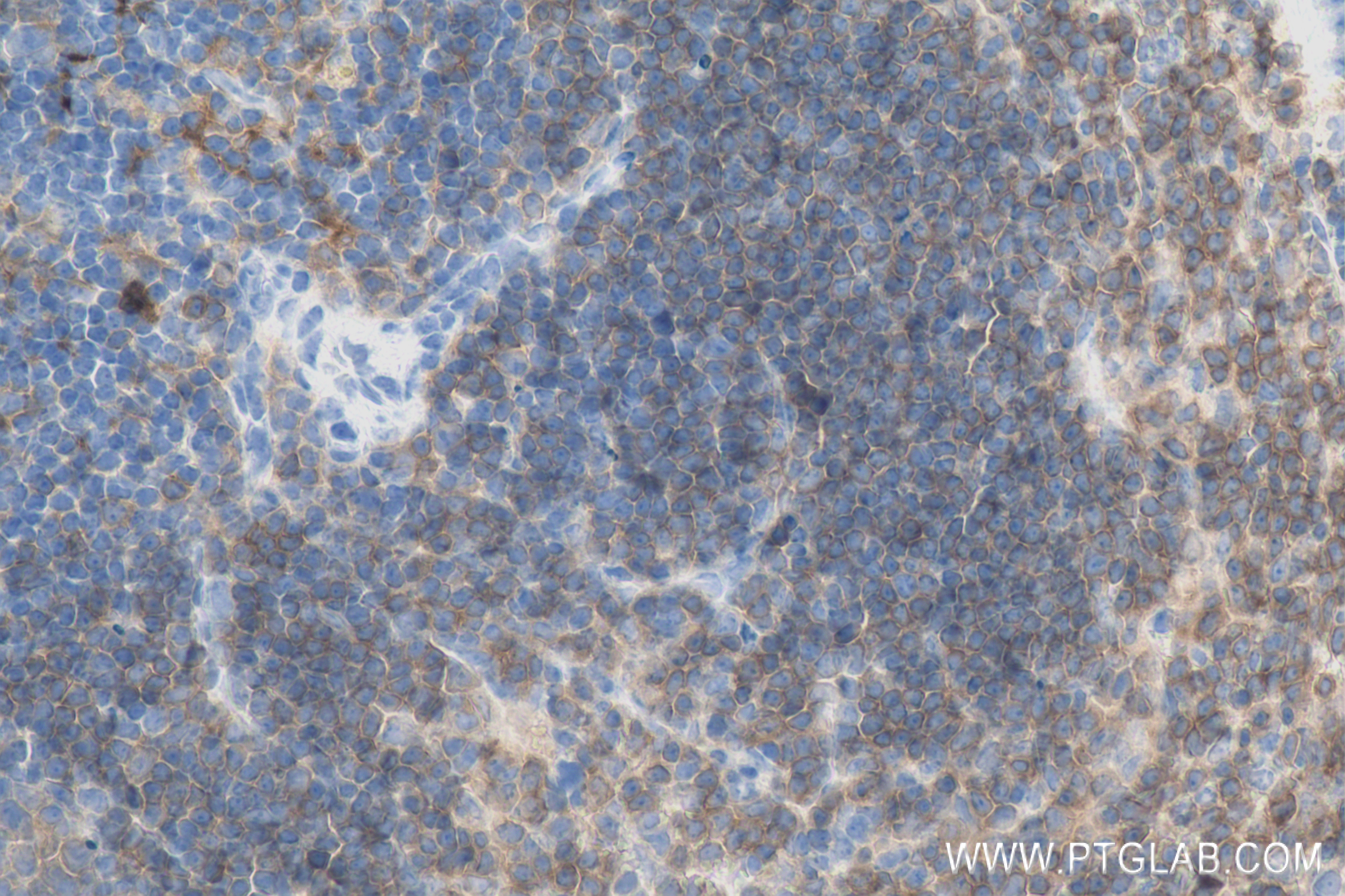 Immunohistochemistry (IHC) staining of mouse spleen tissue using CD40 Recombinant antibody (83972-5-RR)