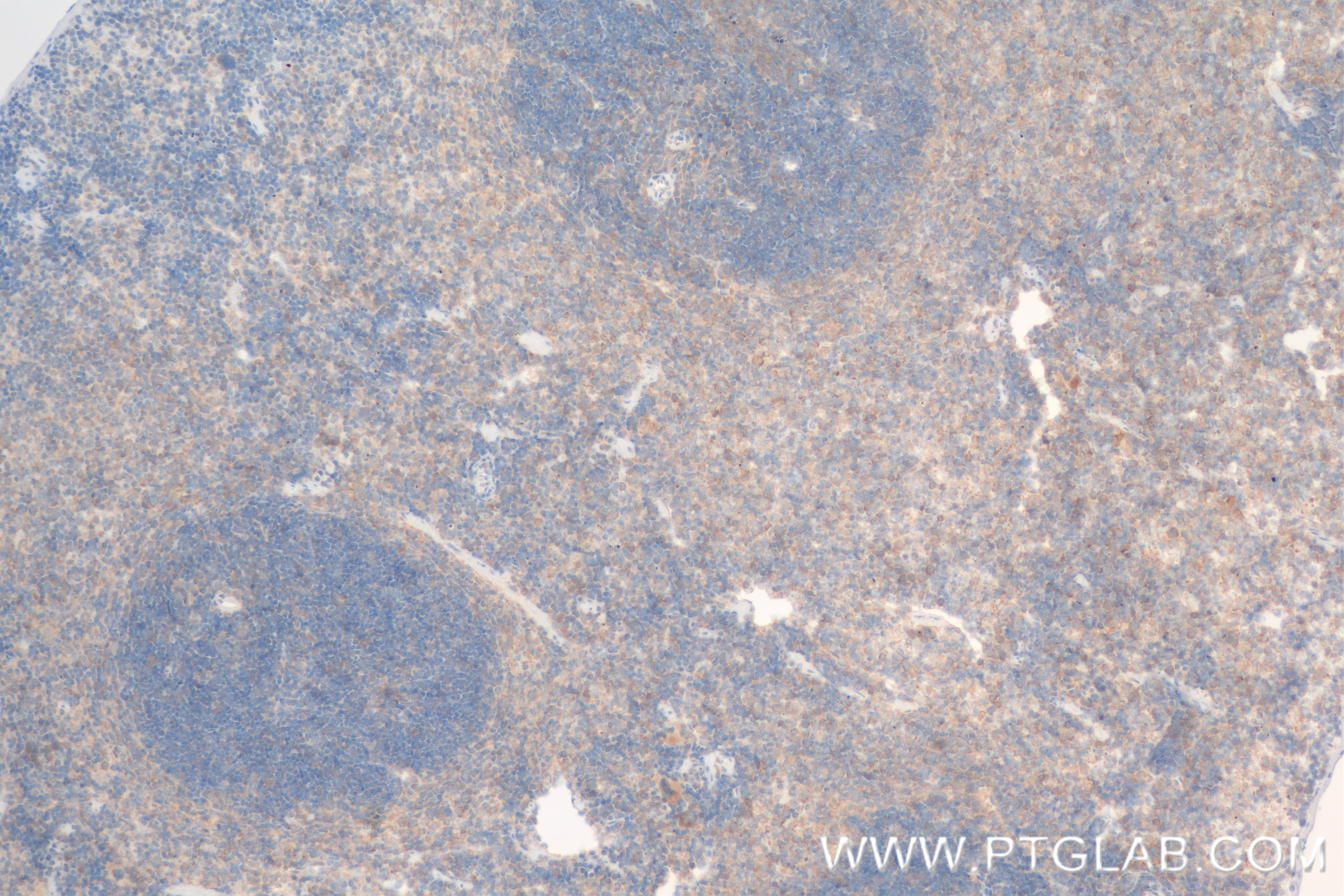 Immunohistochemistry (IHC) staining of mouse spleen tissue using CD40L/CD154 Recombinant antibody (83884-3-RR)