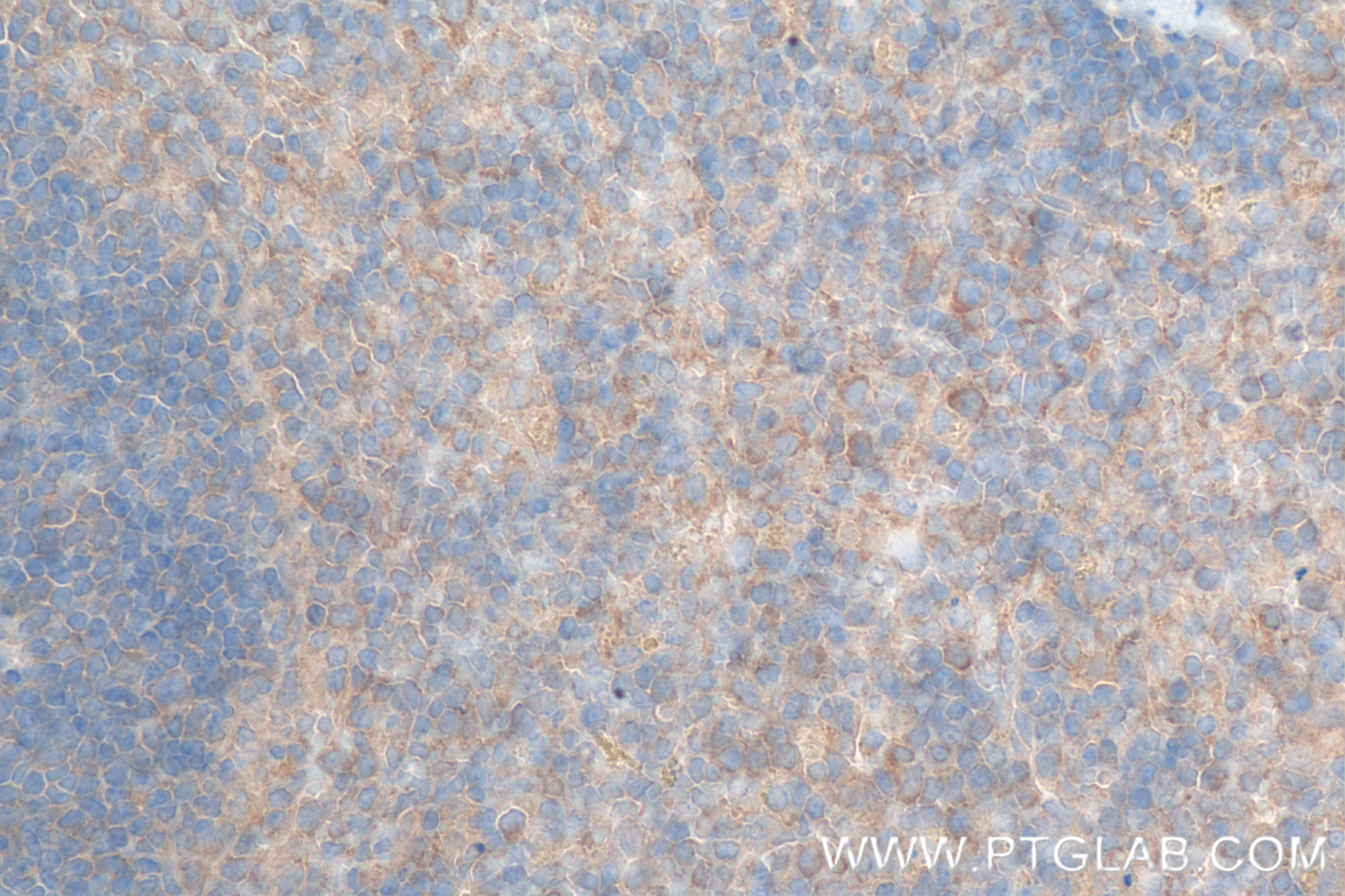 Immunohistochemistry (IHC) staining of mouse spleen tissue using CD40L/CD154 Recombinant antibody (83884-3-RR)