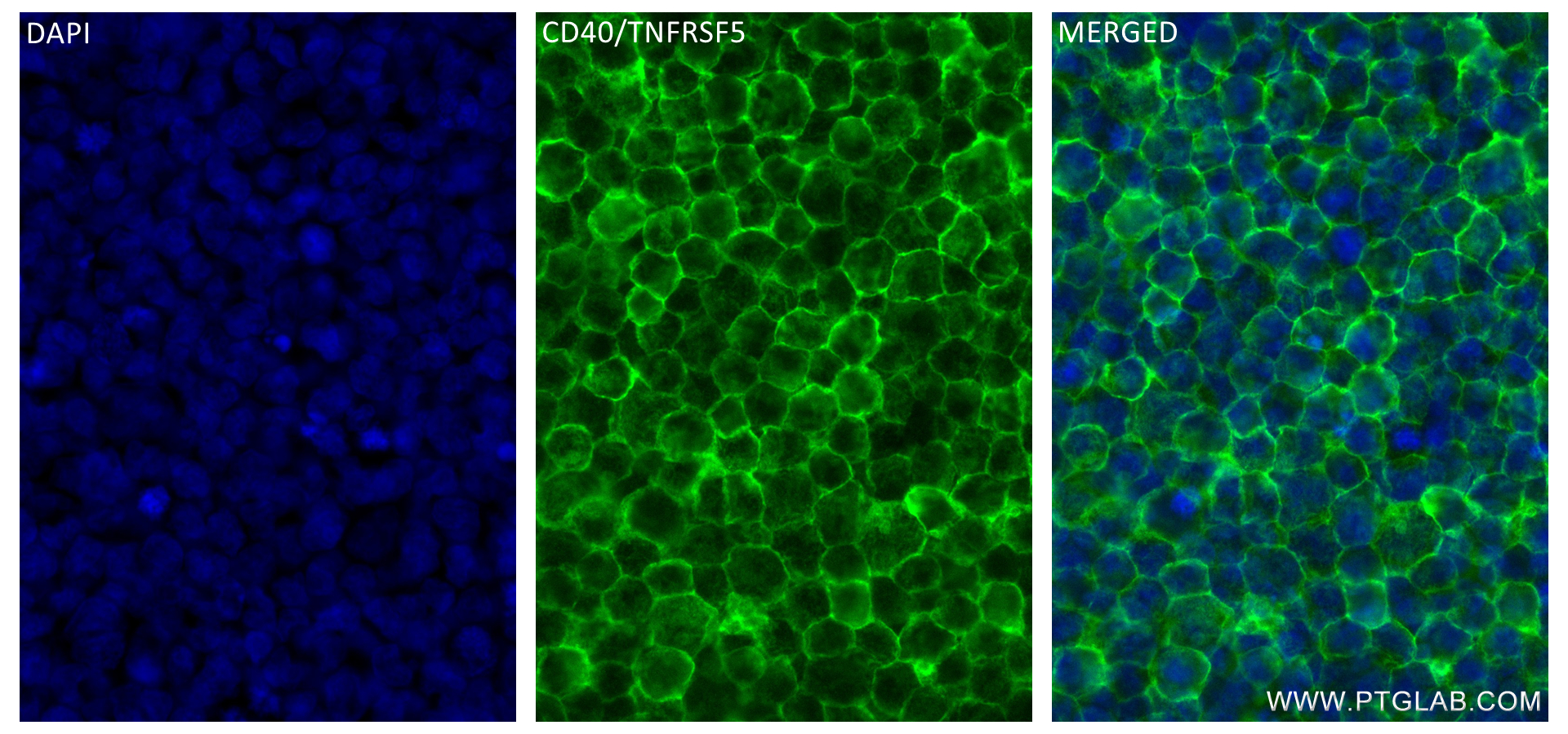 Immunofluorescence (IF) / fluorescent staining of Raji cells using CD40 Recombinant antibody (84406-2-RR)