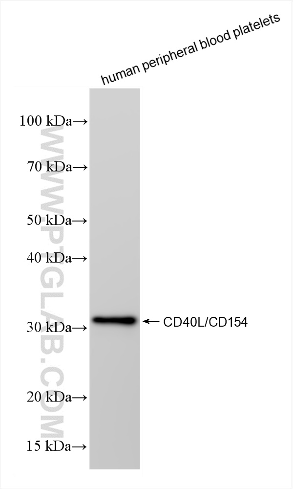 Western Blot (WB) analysis of human peripheral blood platelets using CD40L/CD154 Recombinant antibody (85209-4-RR)