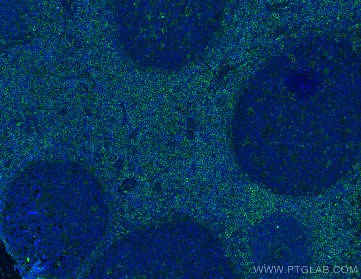 Immunofluorescence (IF) / fluorescent staining of human tonsillitis tissue using CD43 Monoclonal antibody (66224-1-Ig)
