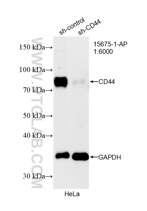 Western Blot (WB) analysis of HeLa cells using CD44 Polyclonal antibody (15675-1-AP)