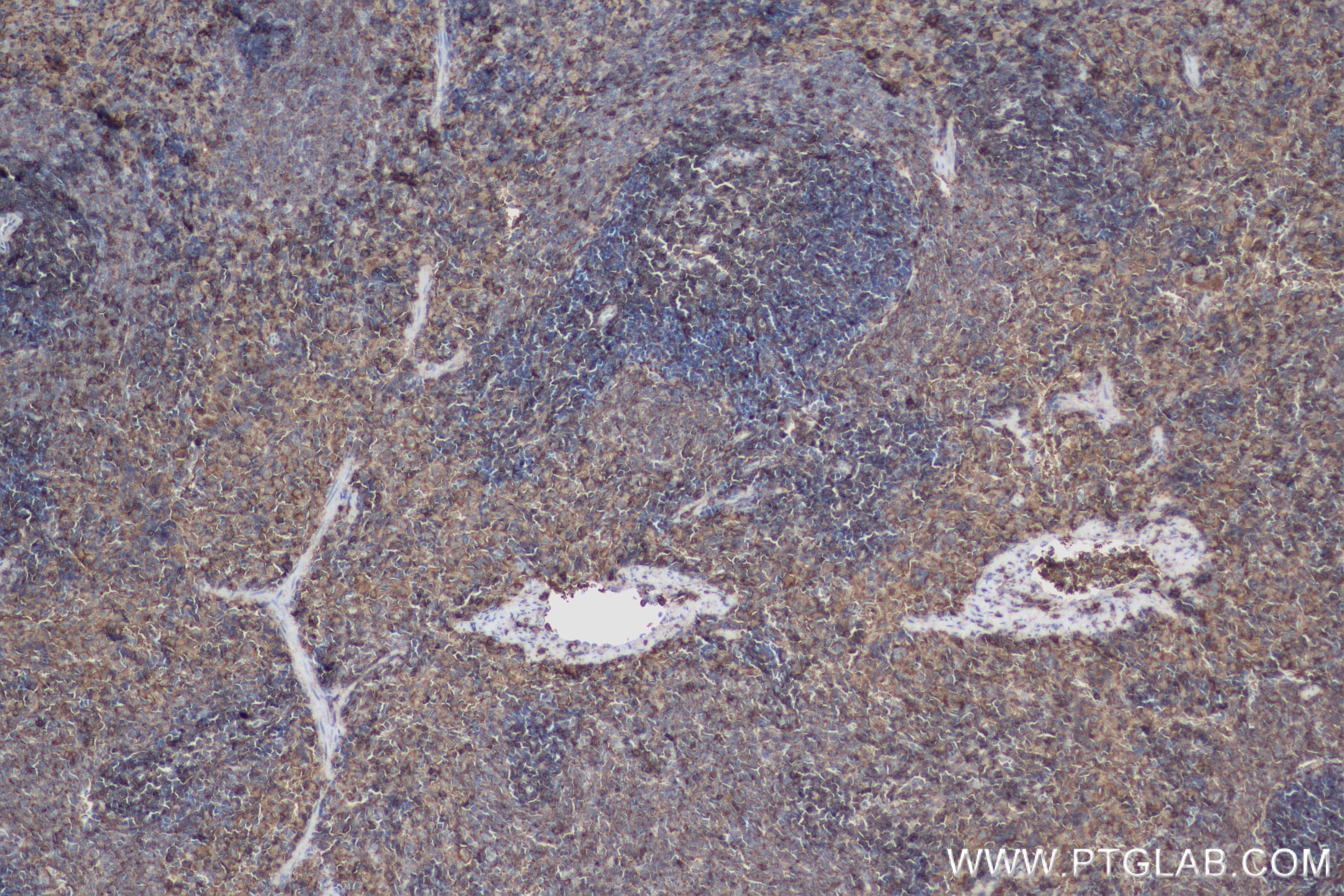 Immunohistochemistry (IHC) staining of rat spleen tissue using CD44 Recombinant antibody (84369-5-RR)