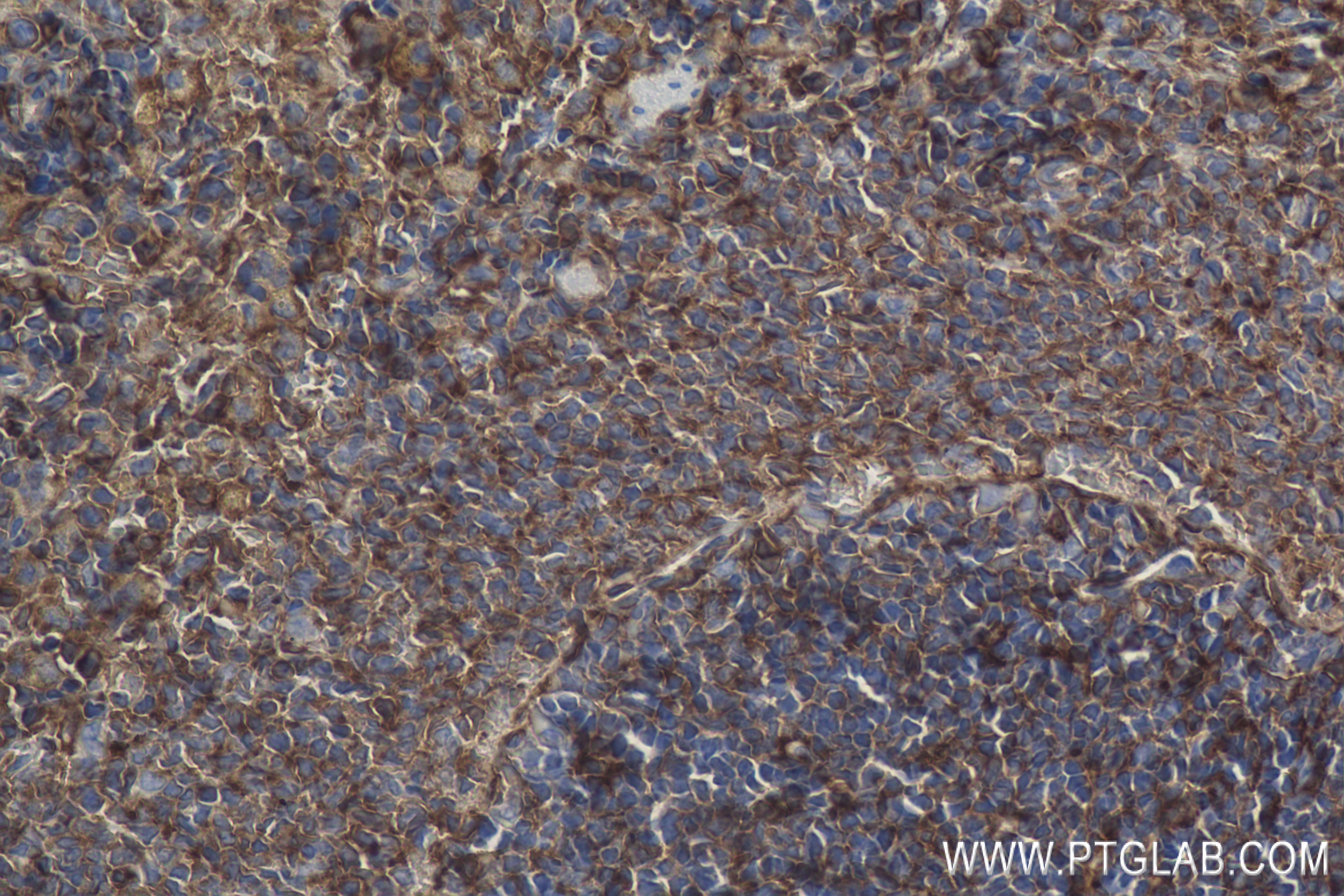 Immunohistochemistry (IHC) staining of rat spleen tissue using CD44 Recombinant antibody (84369-5-RR)