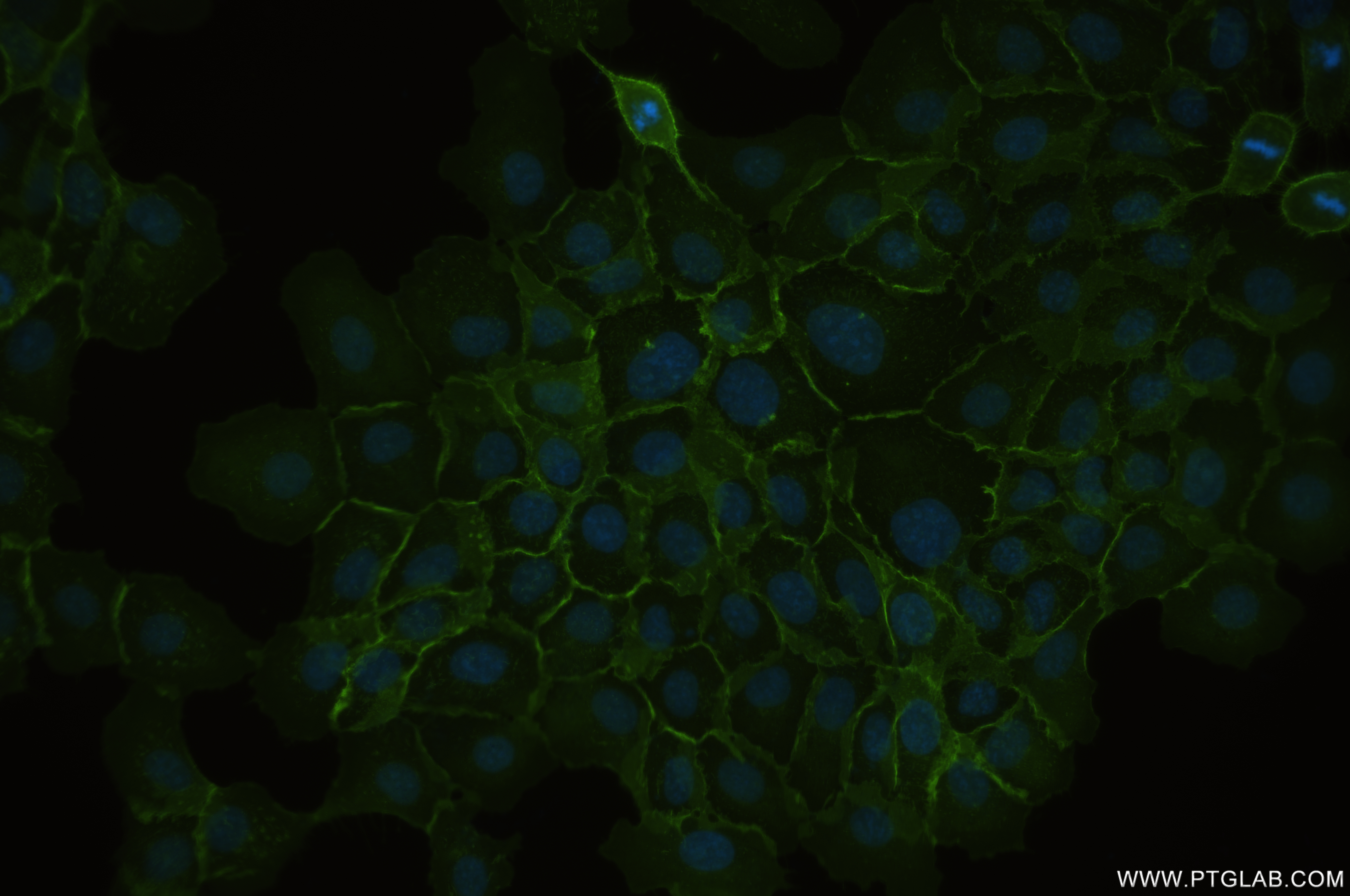 Immunofluorescence (IF) / fluorescent staining of A431 cells using CD44 Recombinant antibody (84854-5-RR)