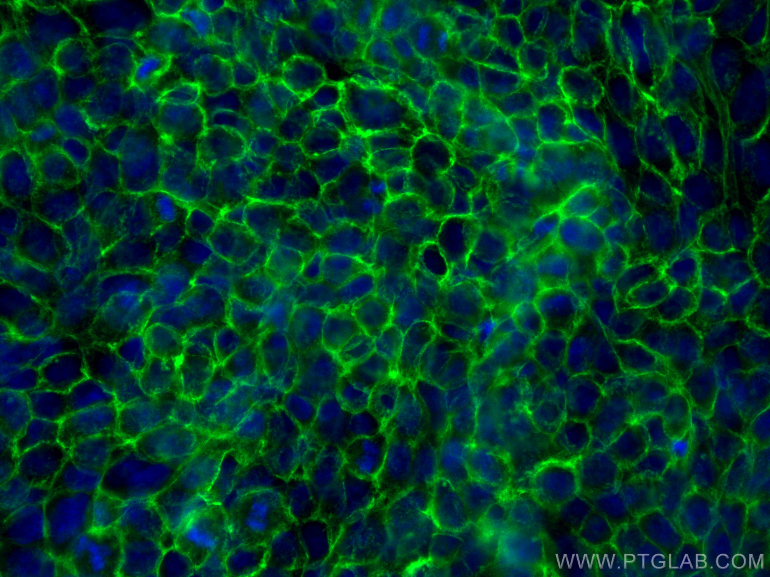 Immunofluorescence (IF) / fluorescent staining of A431 cells using CoraLite® Plus 488-conjugated CD44 Monoclonal anti (CL488-60224)