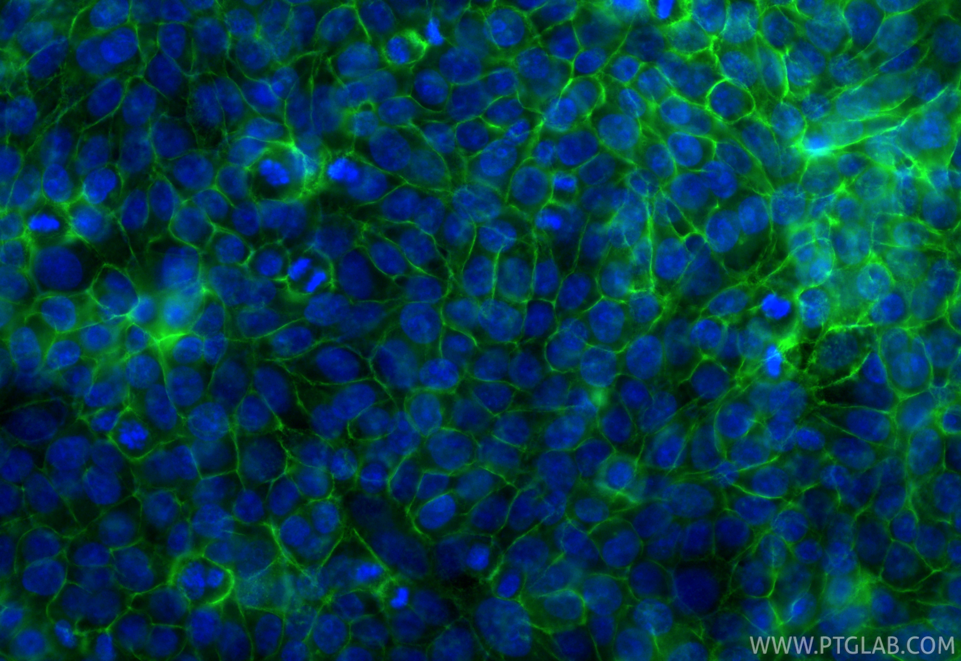 Immunofluorescence (IF) / fluorescent staining of HepG2 cells using CoraLite® Plus 488-conjugated CD44 Recombinant ant (CL488-84854-5)