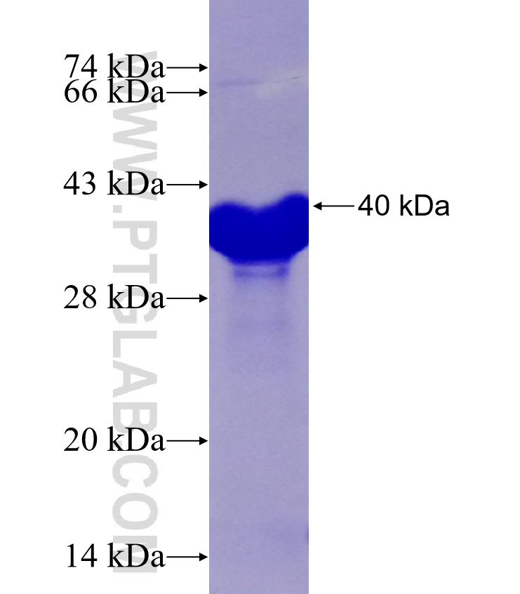 CD44 fusion protein Ag29238 SDS-PAGE