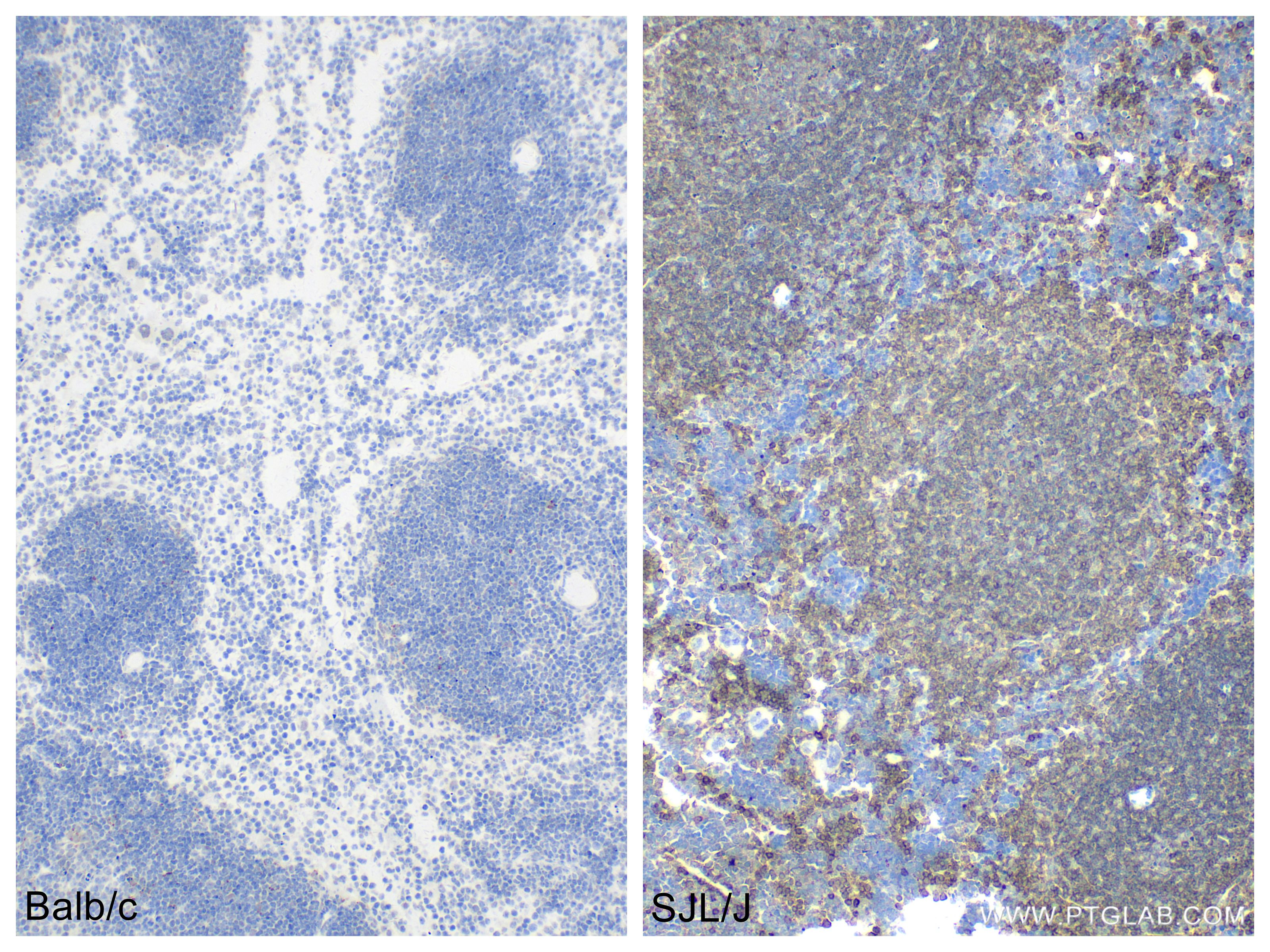 Immunohistochemistry (IHC) staining of mouse spleen tissue using CD45.1 Recombinant antibody (84325-2-RR)