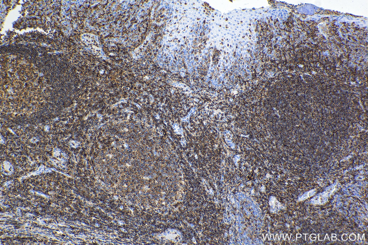 Immunohistochemistry (IHC) staining of human tonsil tissue using Anti-Human CD45 Rabbit Recombinant Antibody (98117-1-RR)