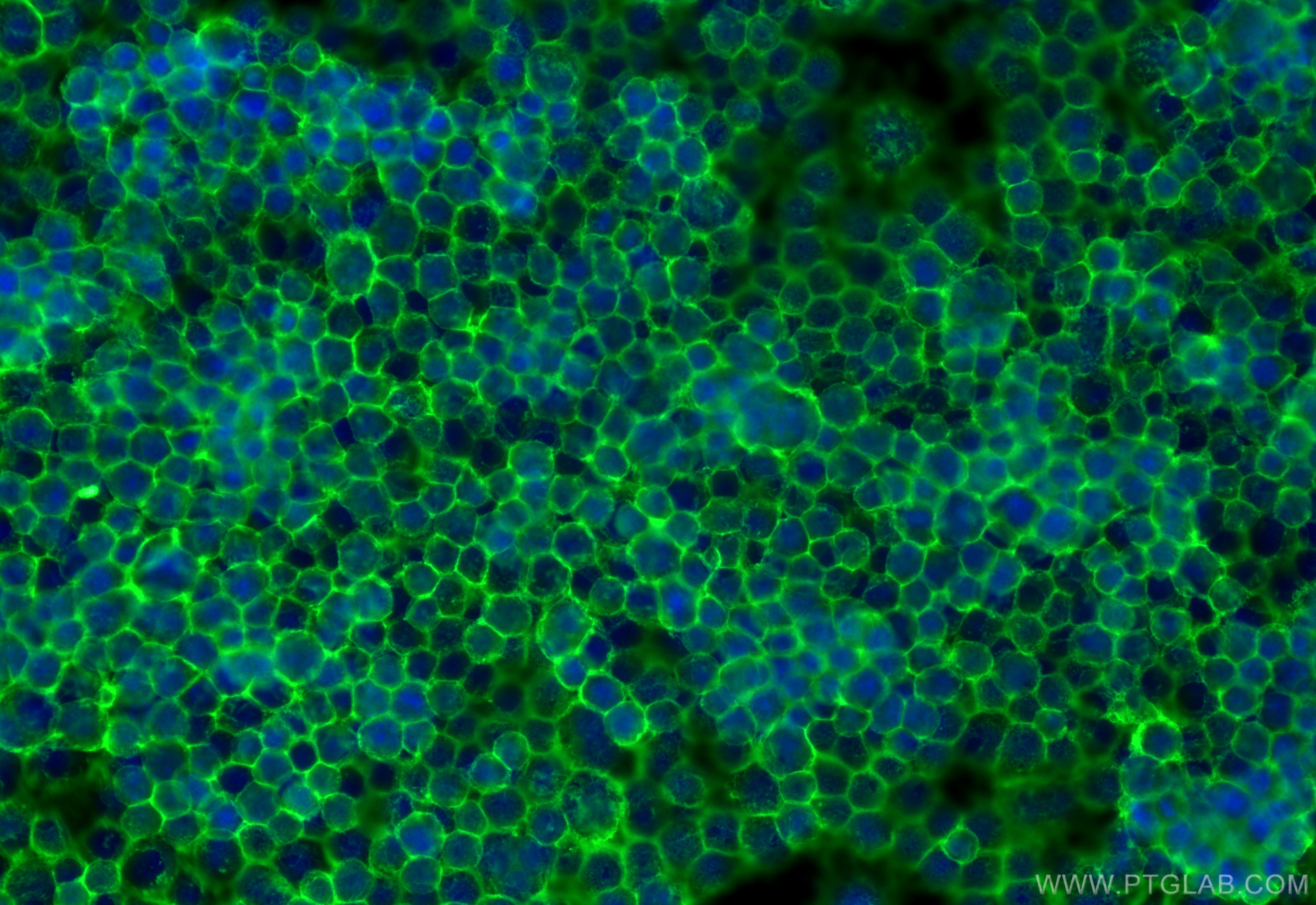 Immunofluorescence (IF) / fluorescent staining of RAW 264.7 cells using CD45 Polyclonal antibody (31243-1-AP)