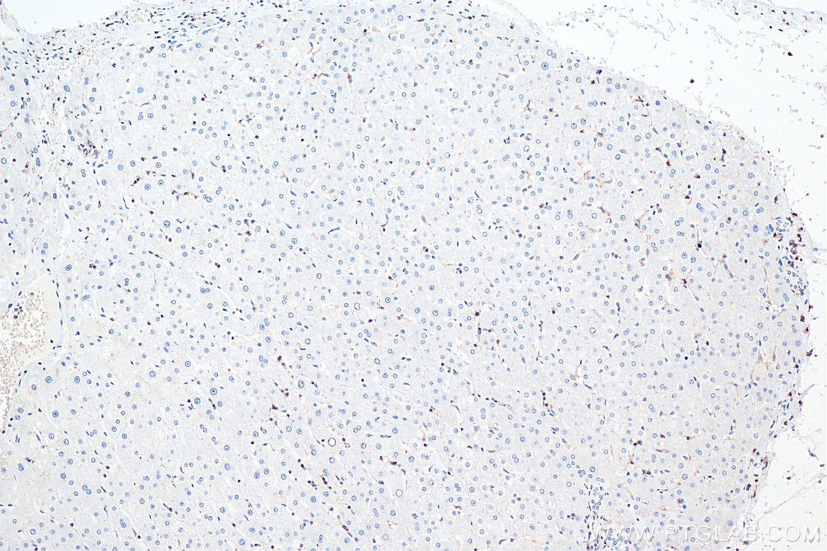 Immunohistochemistry (IHC) staining of human liver tissue using CD45 Monoclonal antibody (60287-1-Ig)