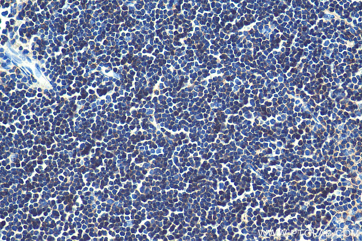 Immunohistochemistry (IHC) staining of rat thymus tissue using CD45 Monoclonal antibody (60287-1-Ig)