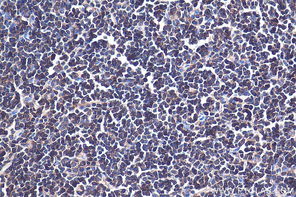 Immunohistochemistry (IHC) staining of mouse spleen tissue using CD45 Monoclonal antibody (60287-1-Ig)