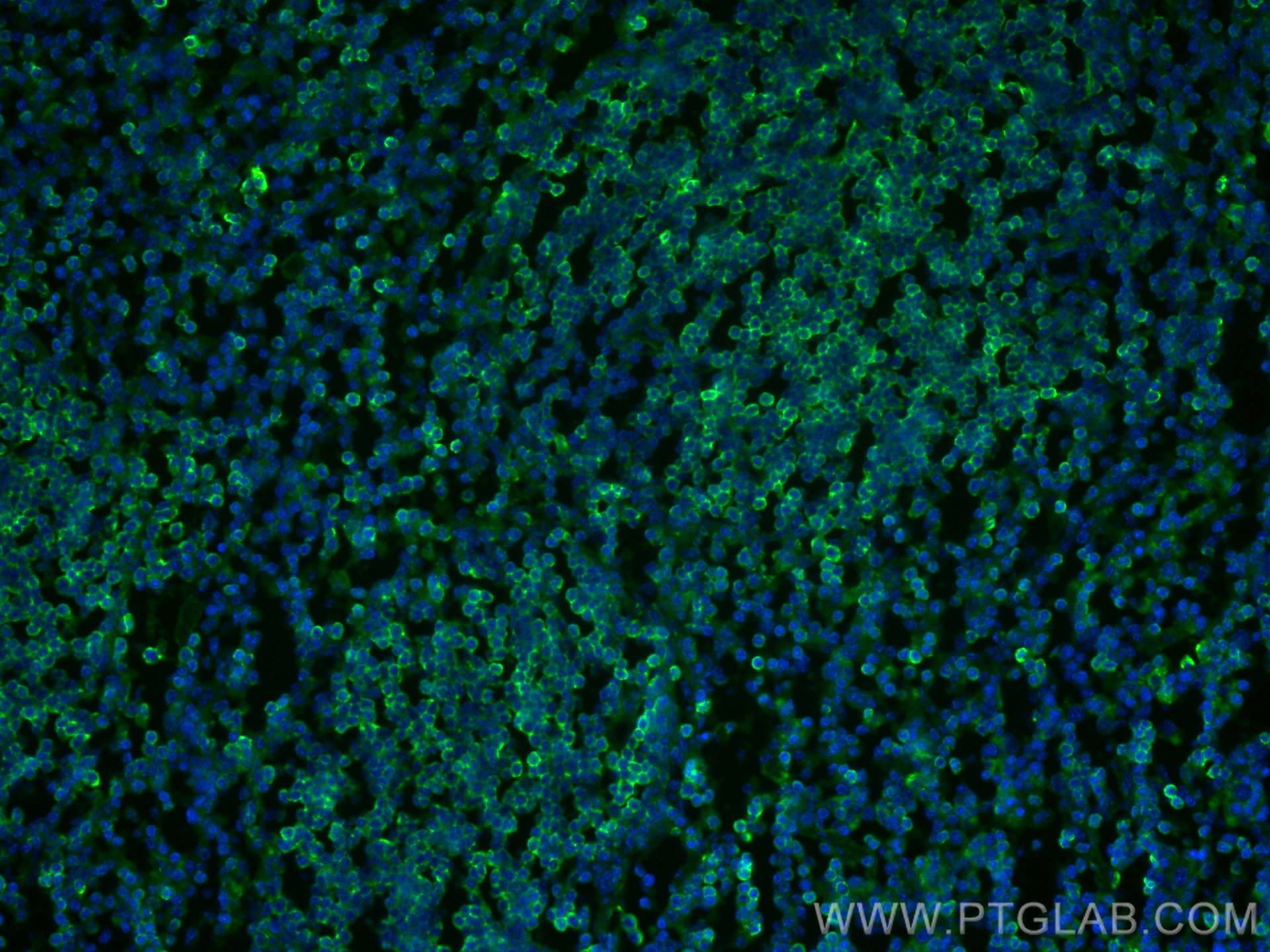 Immunofluorescence (IF) / fluorescent staining of mouse spleen tissue using Anti-Human CD45 (2D1) (65082-1-Ig)