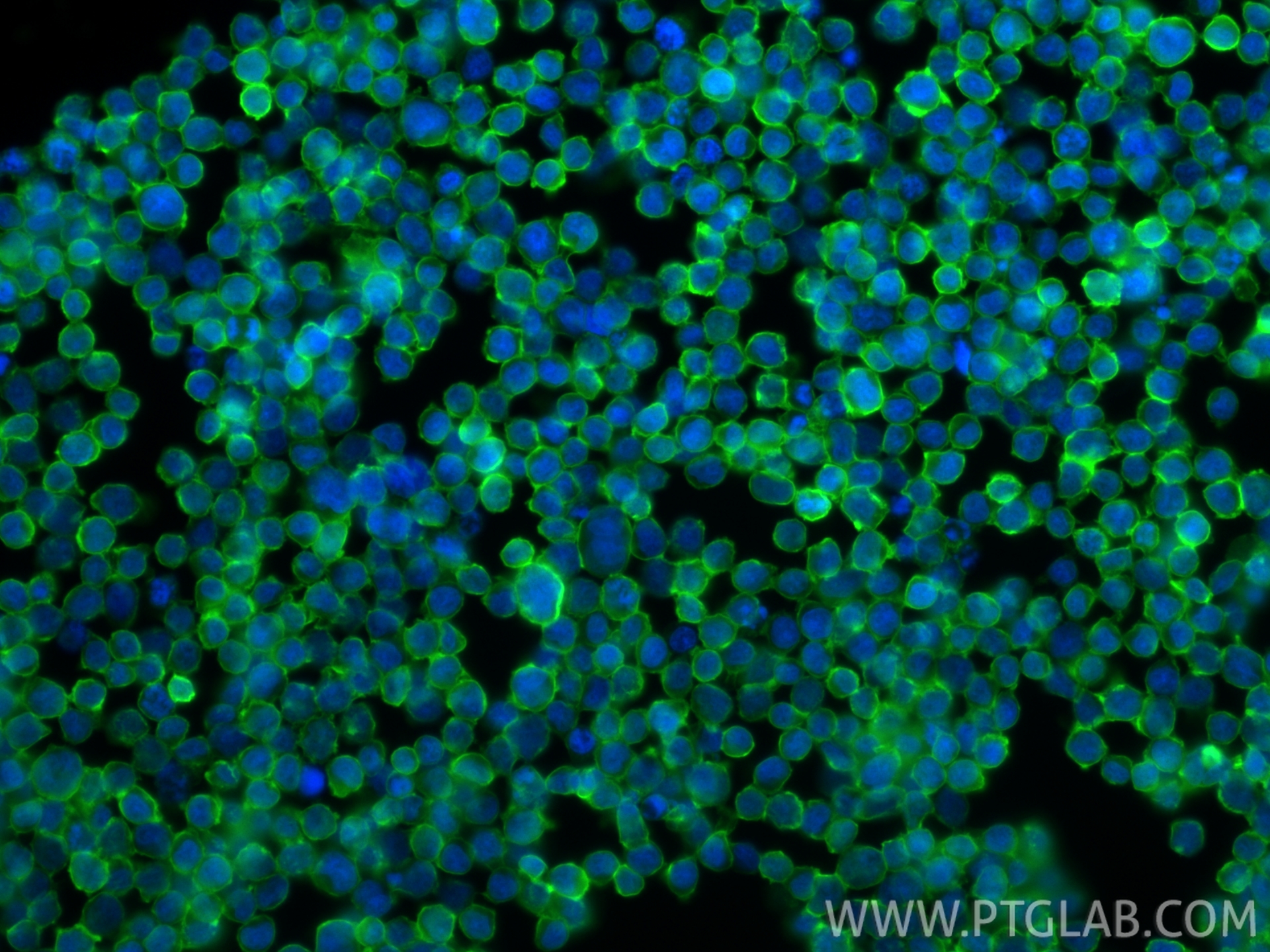 Immunofluorescence (IF) / fluorescent staining of Jurkat cells using Anti-Human CD45 (HI30) (65109-1-Ig)