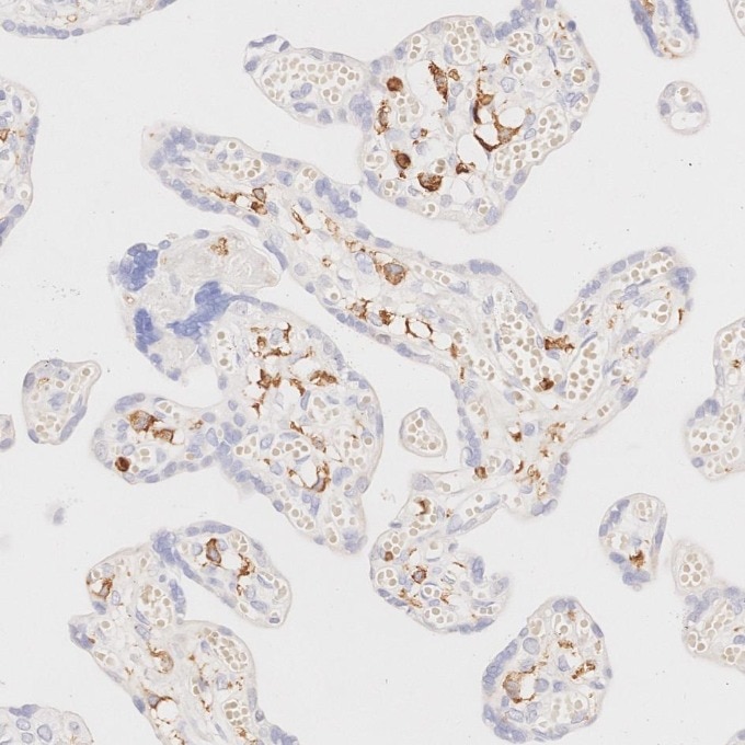 Immunohistochemistry (IHC) staining of human placenta tissue using CD45 Recombinant monoclonal antibody (80297-1-RR)