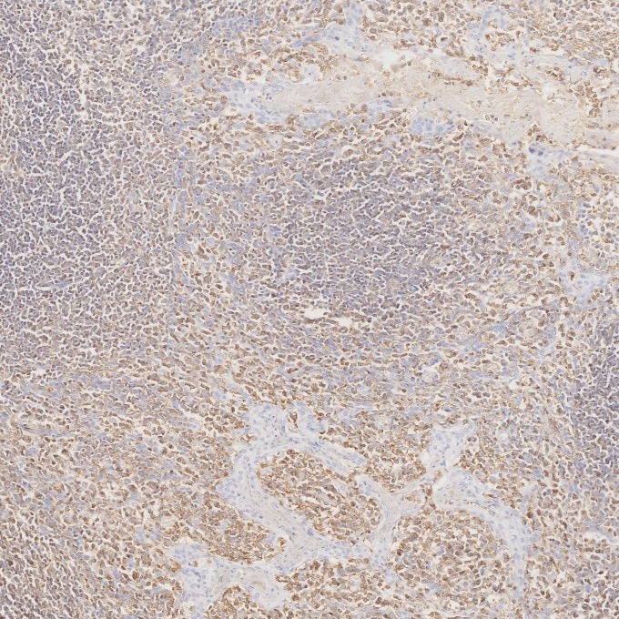 Immunohistochemistry (IHC) staining of human tonsillitis tissue using CD45 Recombinant monoclonal antibody (80297-1-RR)