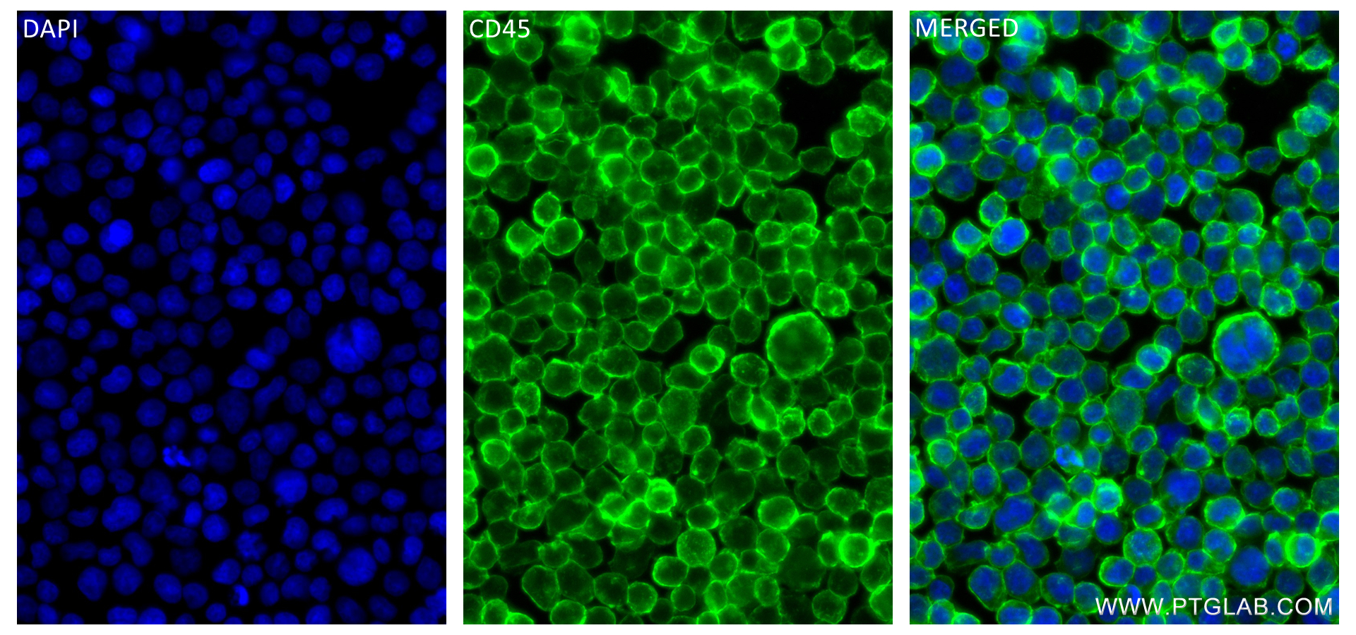 Immunofluorescence (IF) / fluorescent staining of Jurkat cells using CD45 Recombinant antibody (84405-6-RR)