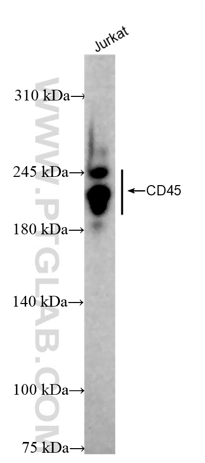 Western Blot (WB) analysis of Jurkat cells using CD45 Recombinant antibody (84405-6-RR)