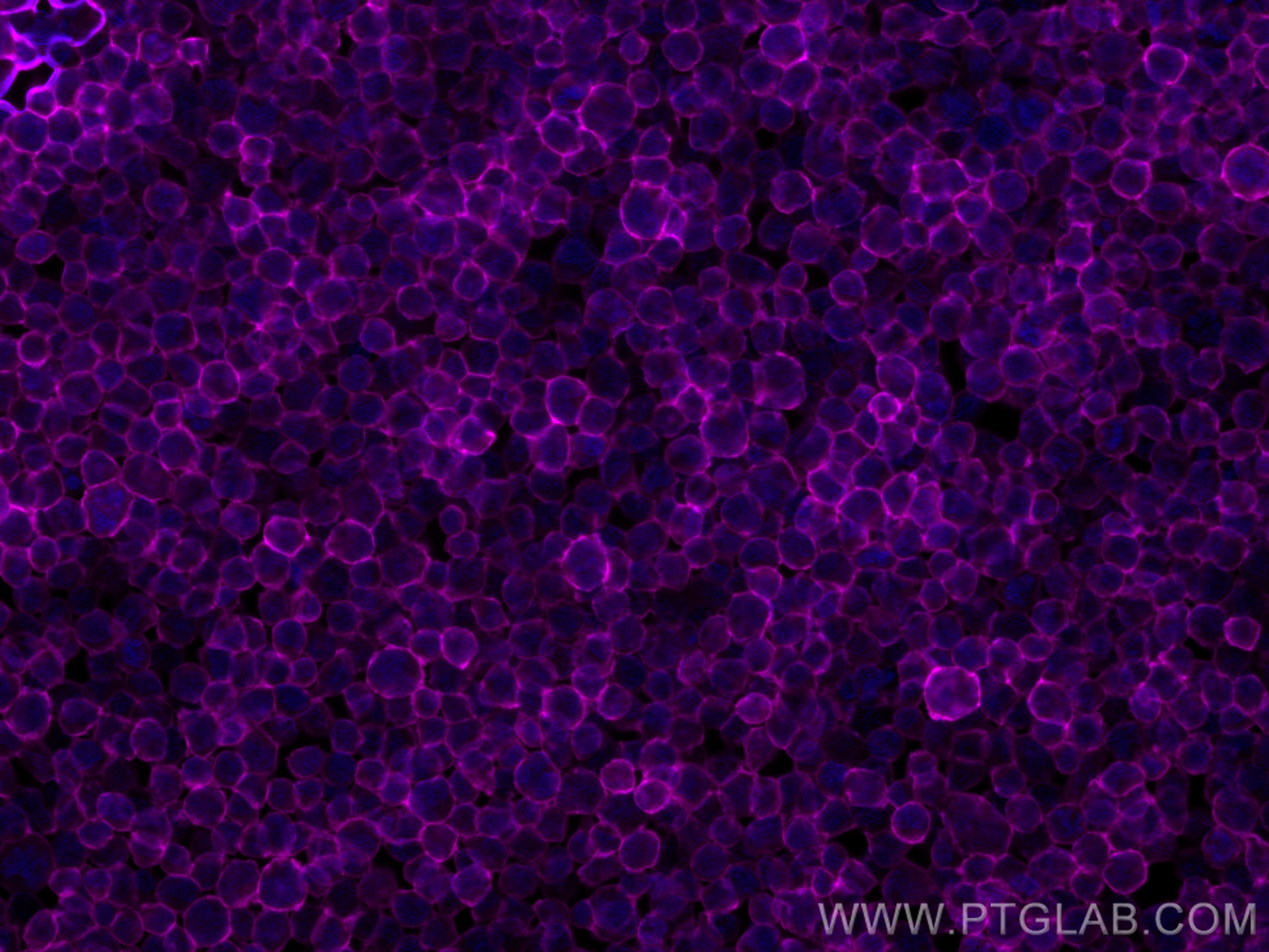 Immunofluorescence (IF) / fluorescent staining of Jurkat cells using FcZero-rAb™ APC Anti-Human CD45 Rabbit Recombinant (APC-FcA98117)