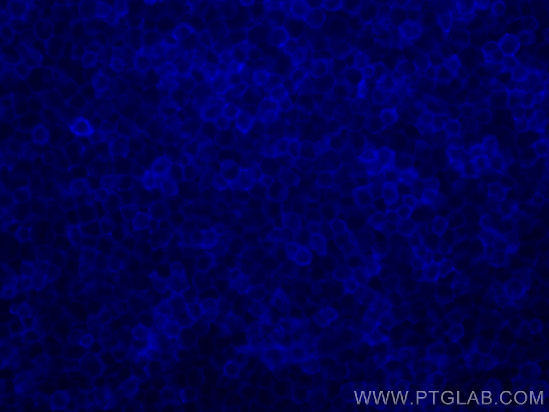Immunofluorescence (IF) / fluorescent staining of Jurkat cells using FcZero-rAb™ CoraLite® Plus 405 Anti-Human CD45 Rab (CL405-FcA98117)