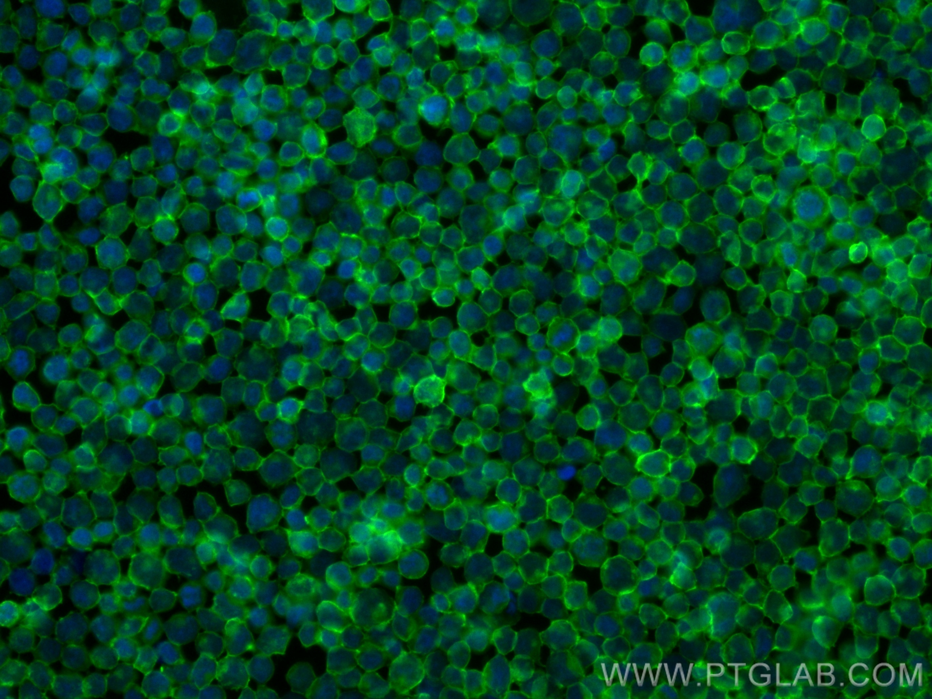 Immunofluorescence (IF) / fluorescent staining of Jurkat cells using FcZero-rAb™ CoraLite® Plus 488 Anti-Human CD45 Rab (CL488-FcA98117)