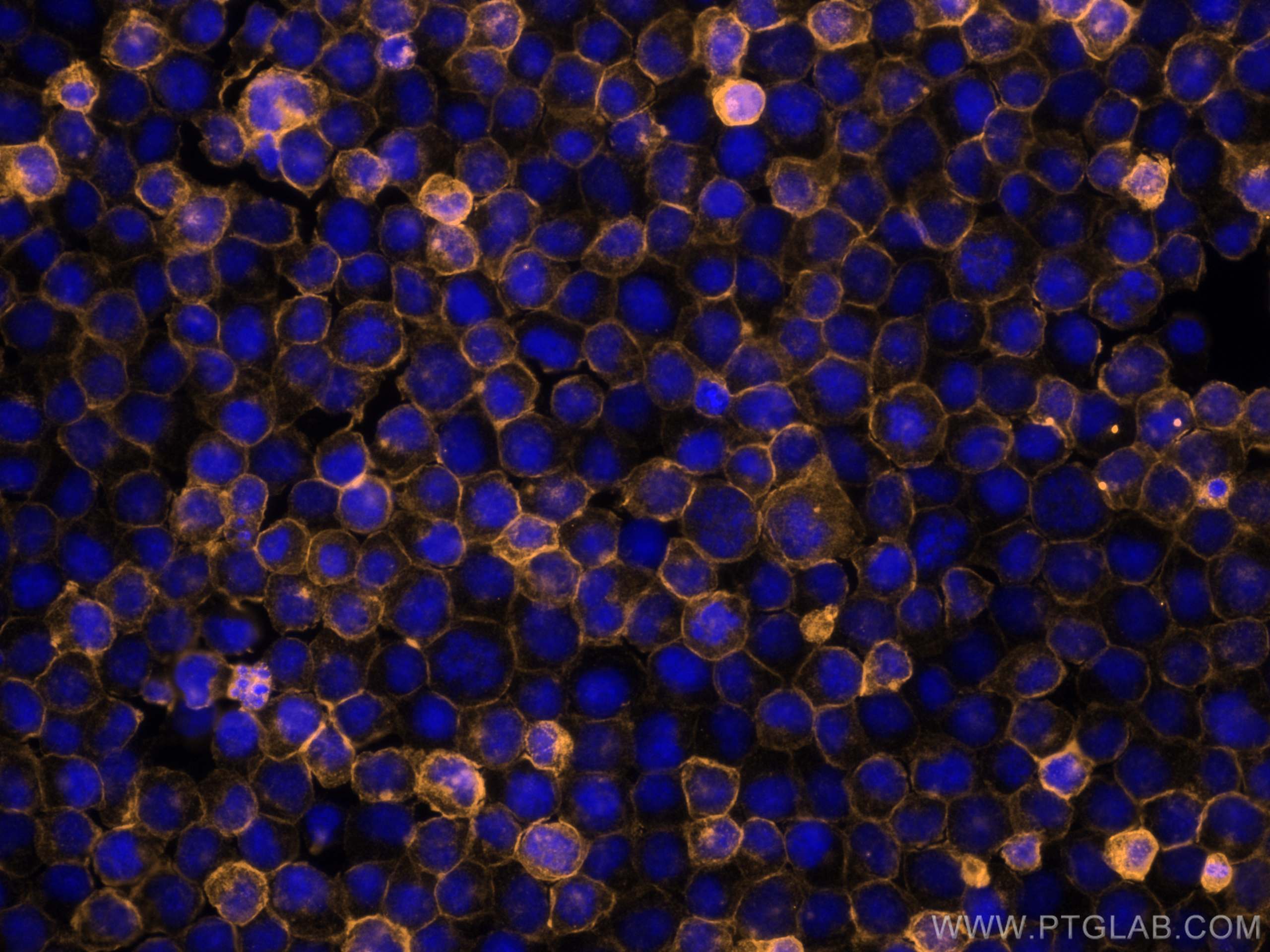 Immunofluorescence (IF) / fluorescent staining of Jurkat cells using CoraLite® Plus 555 Anti-Human CD45 (HI30) (CL555-65109)
