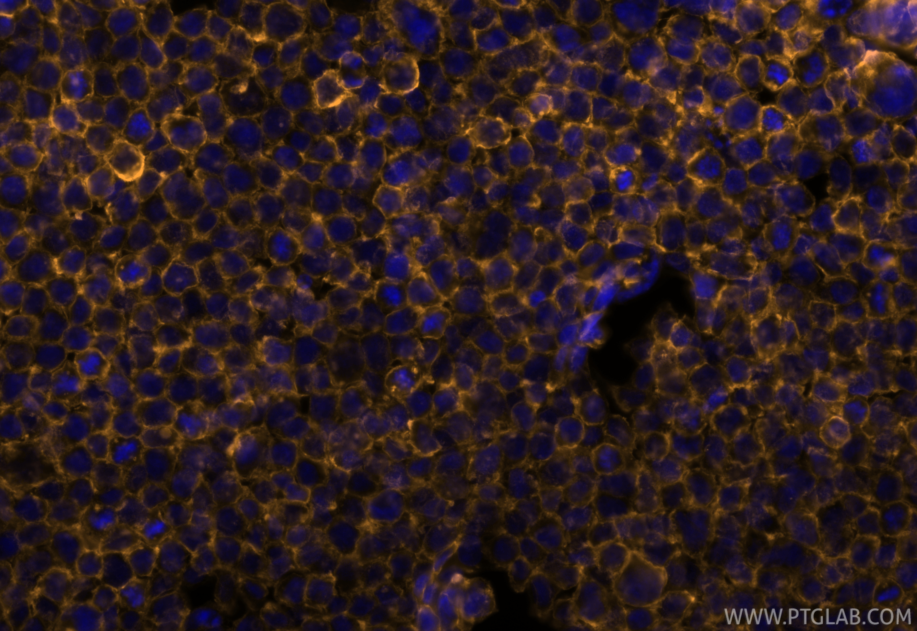 Immunofluorescence (IF) / fluorescent staining of THP-1 cells using CoraLite® Plus 555 Anti-Human CD45 (HI30) (CL555-65109)