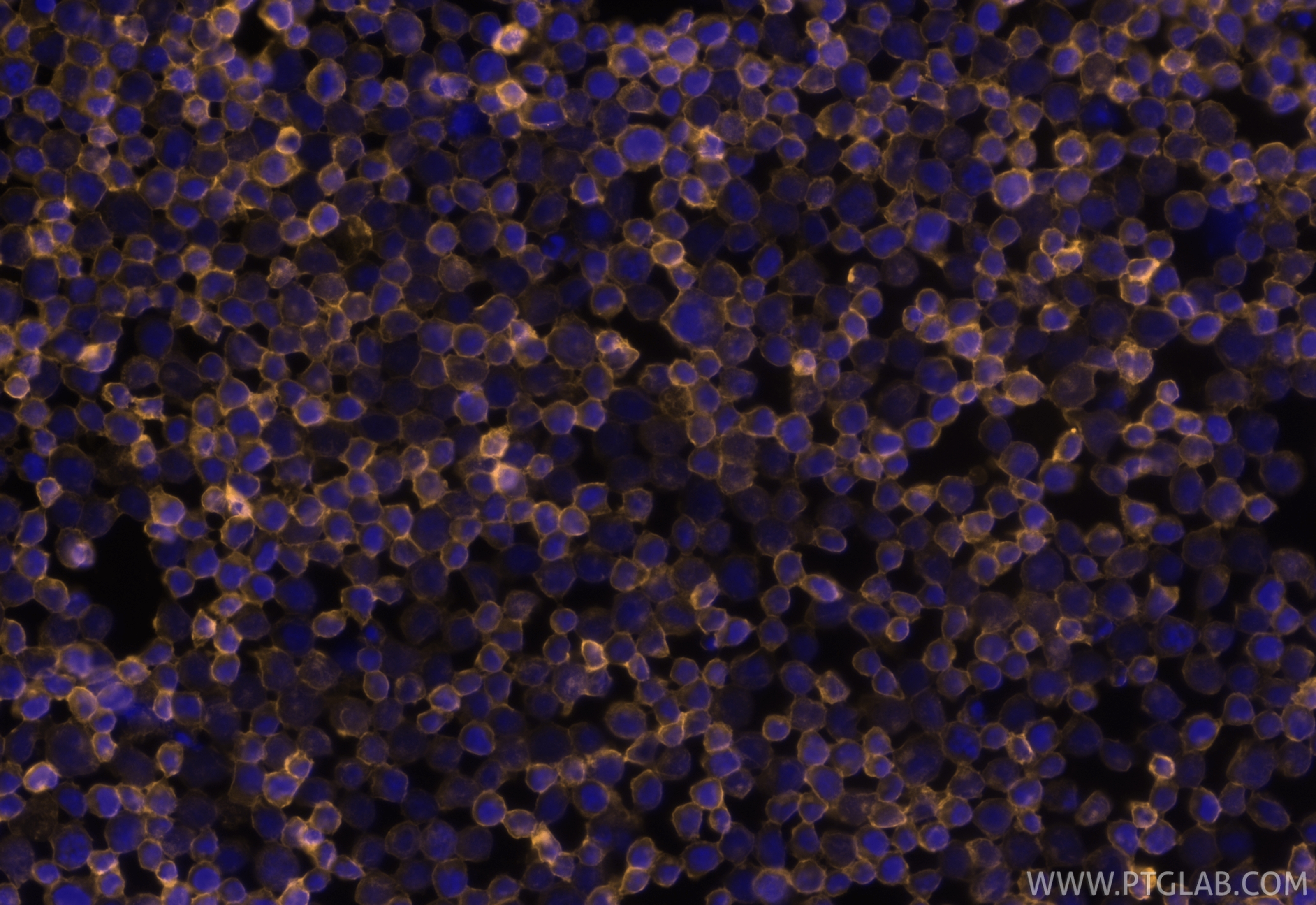 Immunofluorescence (IF) / fluorescent staining of Jurkat cells using PE Anti-Human CD45 Rabbit Recombinant Antibody (PE-98117)