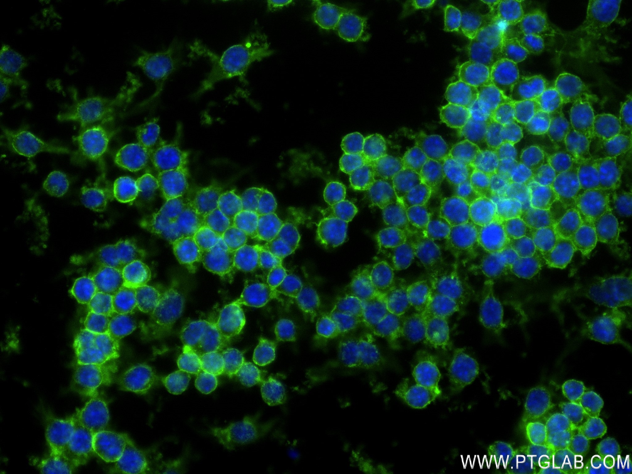 Immunofluorescence (IF) / fluorescent staining of RAW 264.7 cells using CD45 Recombinant antibody (83396-5-RR)