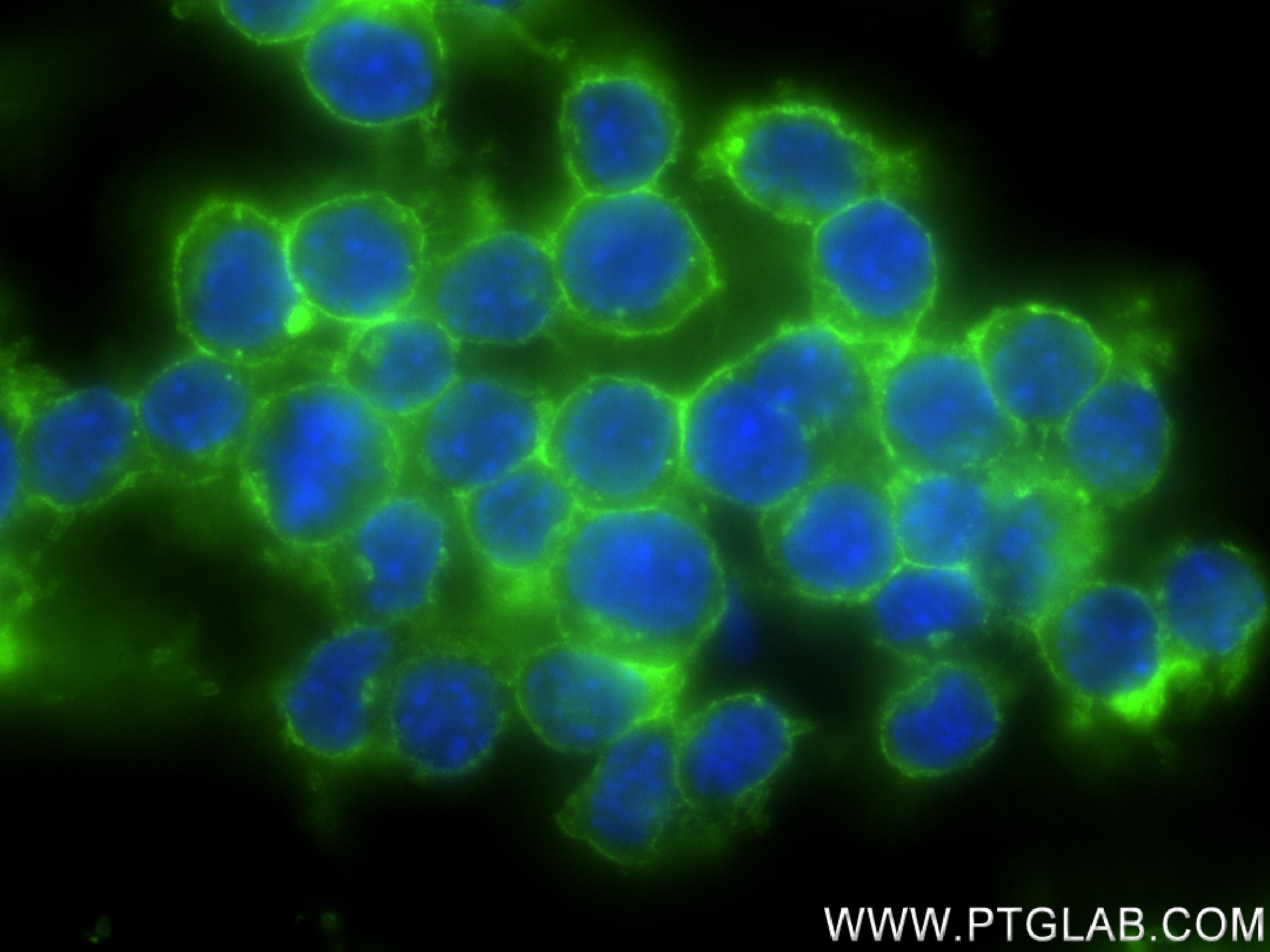 Immunofluorescence (IF) / fluorescent staining of RAW 264.7 cells using CD45/PTPRC Recombinant antibody (83396-5-RR)