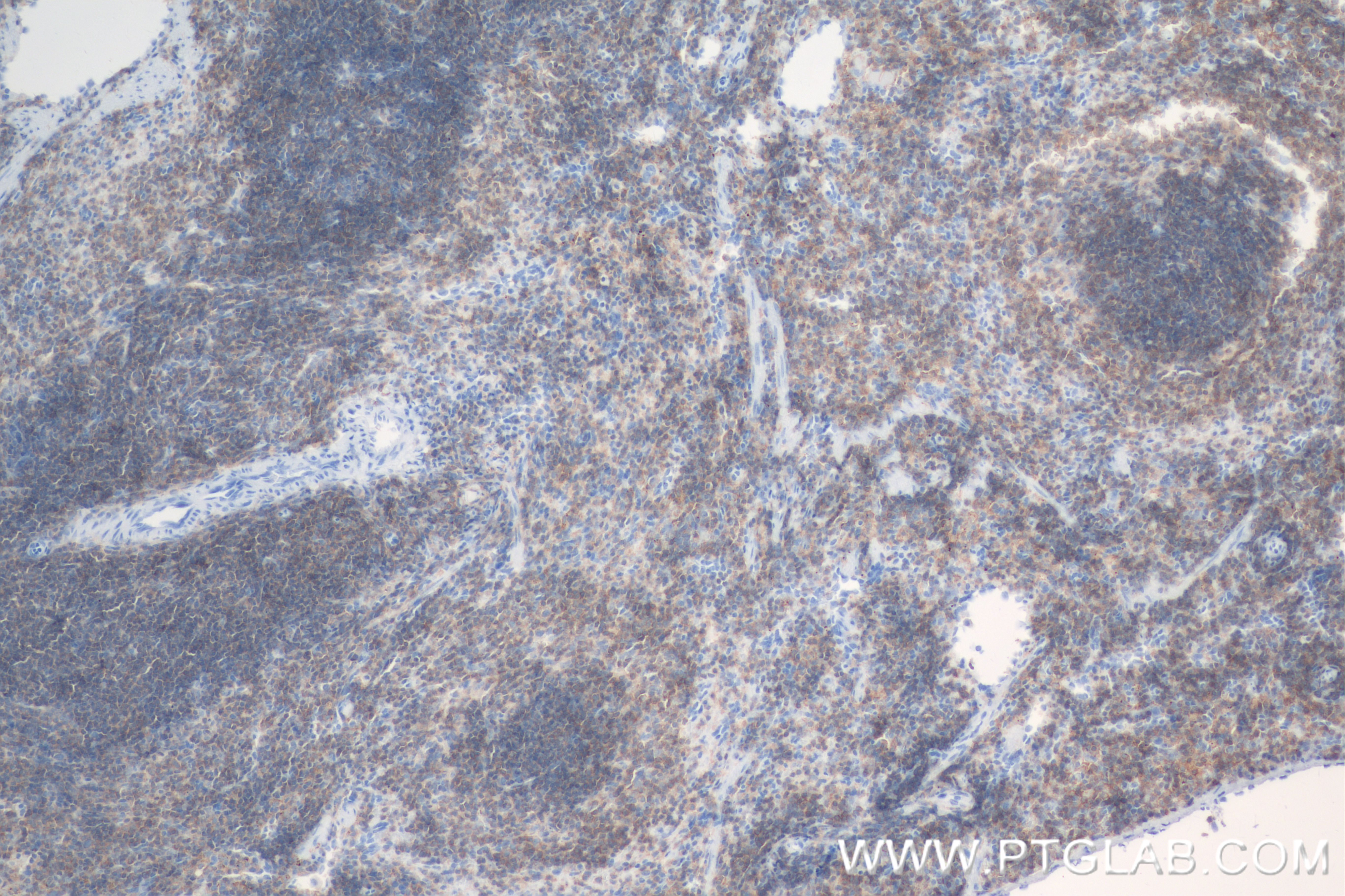 Immunohistochemistry (IHC) staining of mouse spleen tissue using CD45 Recombinant antibody (83396-5-RR)