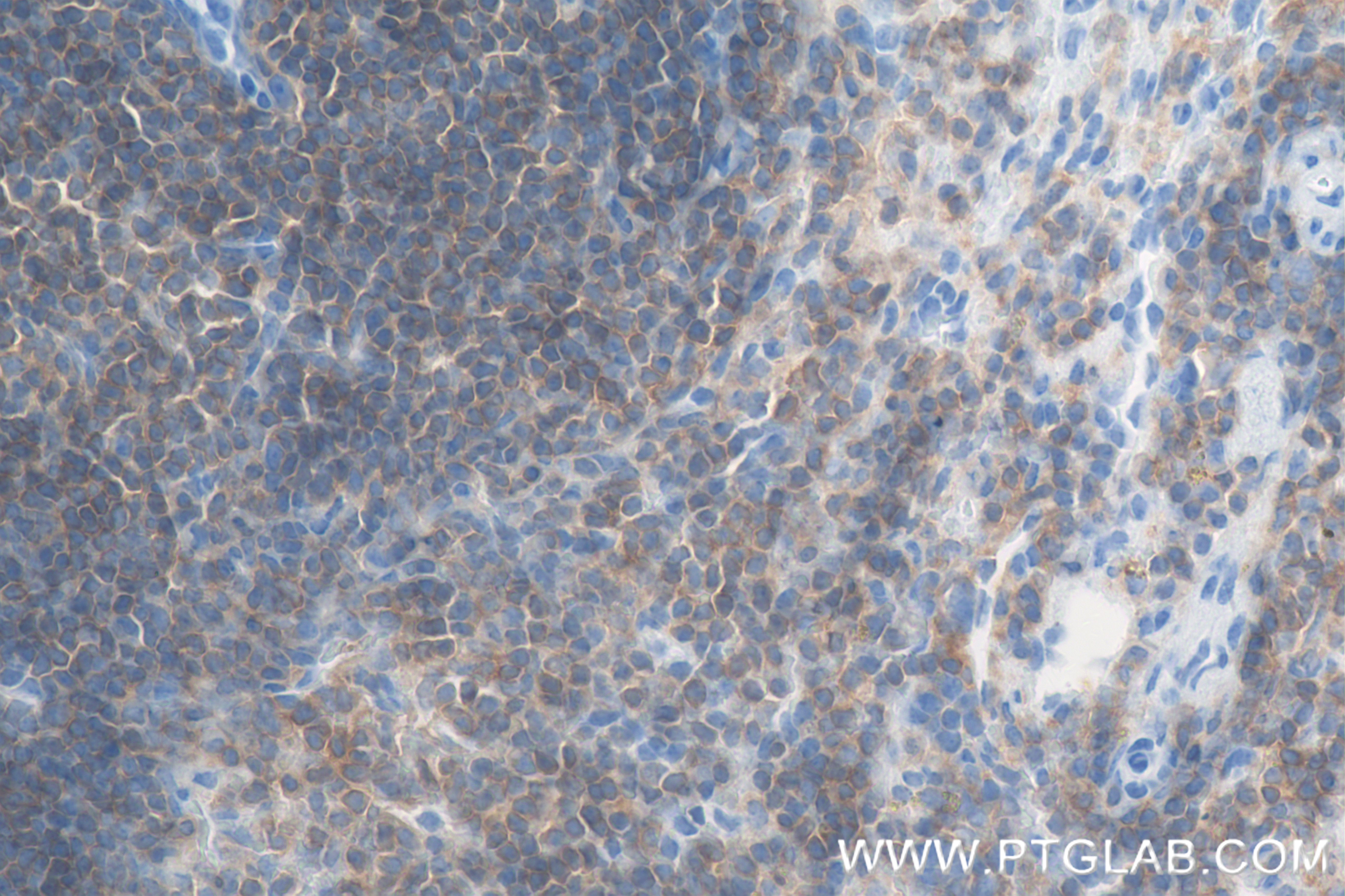 Immunohistochemistry (IHC) staining of mouse spleen tissue using CD45 Recombinant antibody (83396-5-RR)