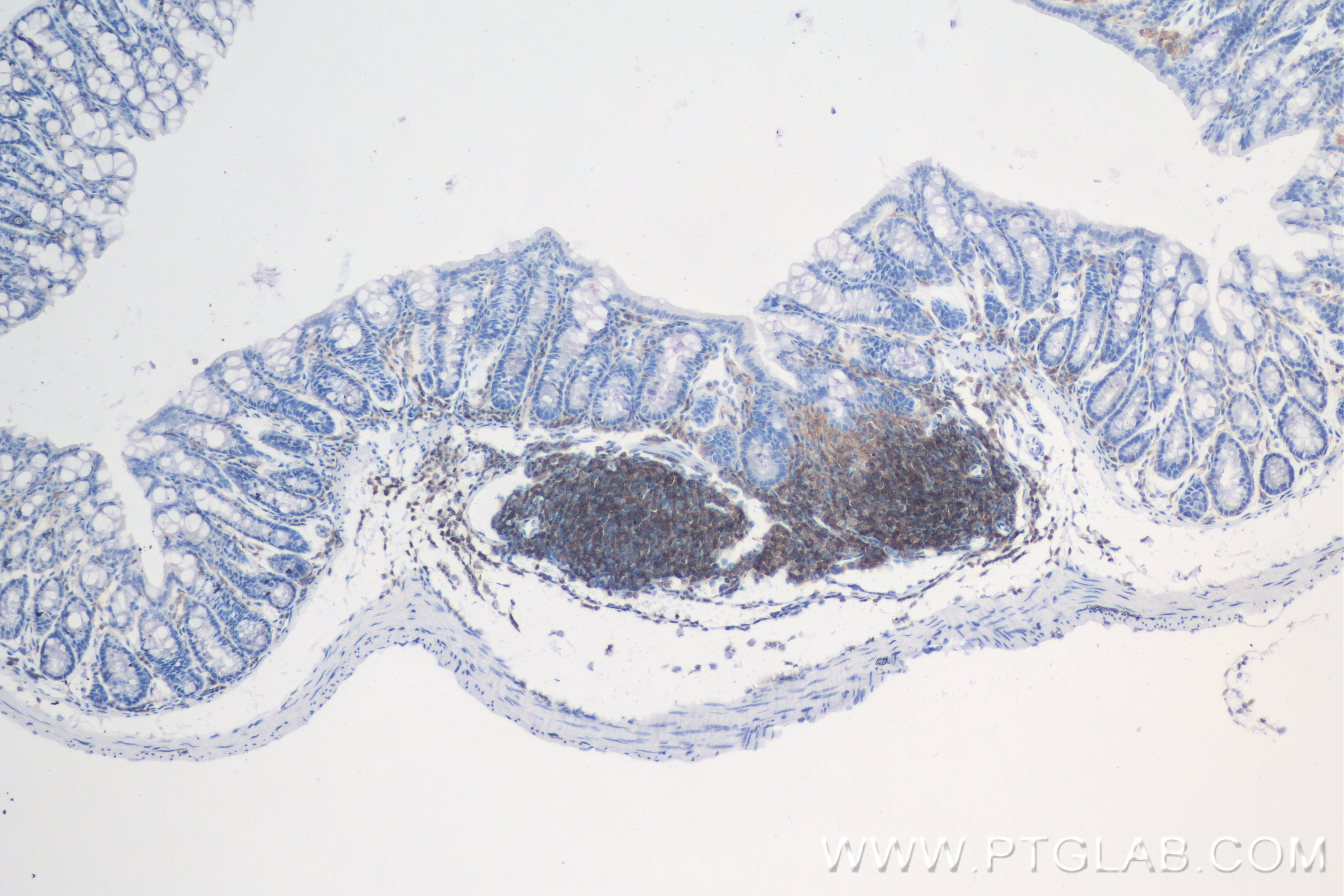 Immunohistochemistry (IHC) staining of mouse colon tissue using CD45 Recombinant antibody (83396-5-RR)