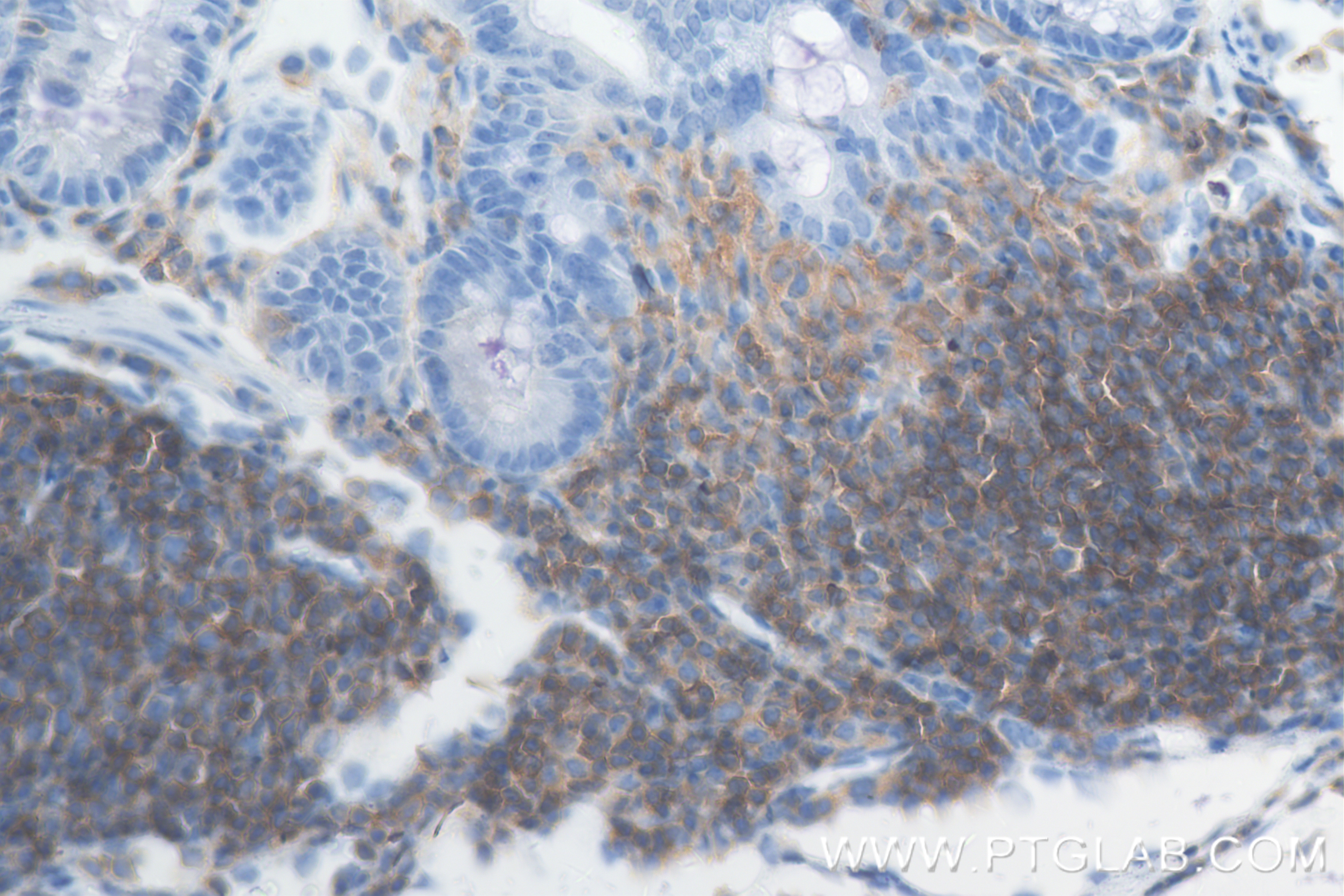 Immunohistochemistry (IHC) staining of mouse colon tissue using CD45 Recombinant antibody (83396-5-RR)