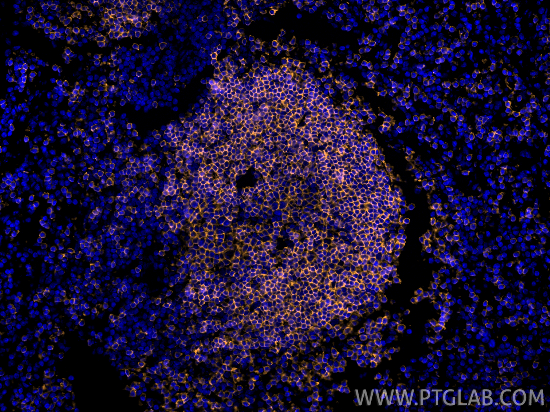 Immunofluorescence (IF) / fluorescent staining of mouse spleen tissue using Anti-Mouse CD45R (B220) (RA3-6B2) (65139-1-Ig)