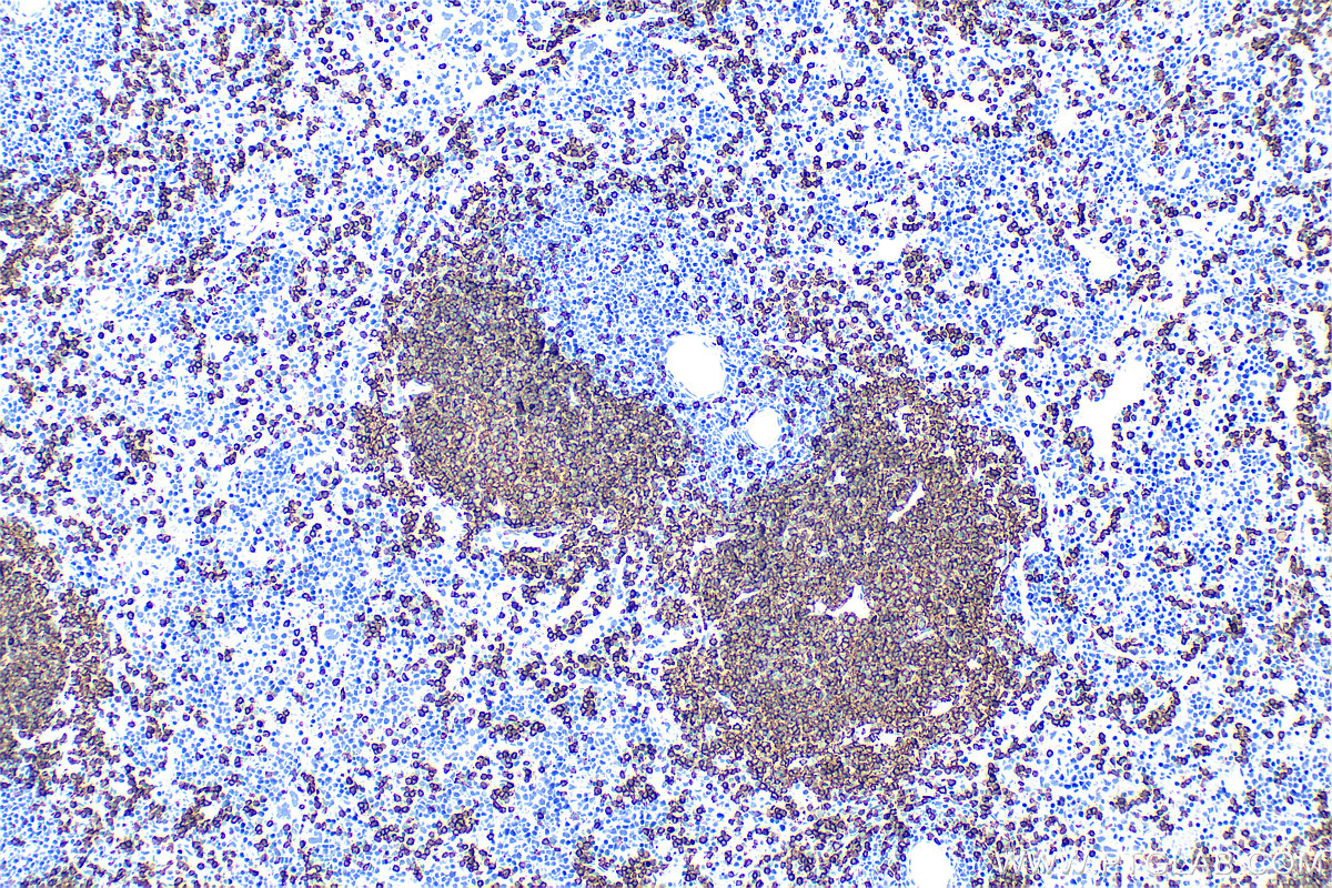 Immunohistochemistry (IHC) staining of mouse spleen tissue using Anti-Mouse CD45R (B220) (RA3-6B2) (65139-1-Ig)