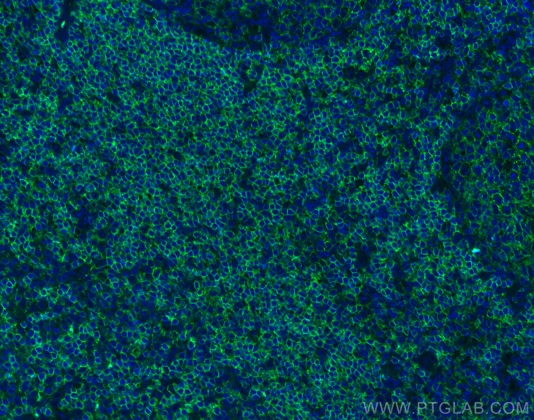 Immunofluorescence (IF) / fluorescent staining of human tonsillitis tissue using Anti-Human CD45RA (F8-11-13) (65226-1-Ig)