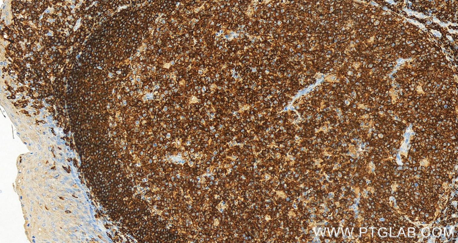 Immunohistochemistry (IHC) staining of human tonsillitis tissue using Anti-Human CD45RA (F8-11-13) (65226-1-Ig)