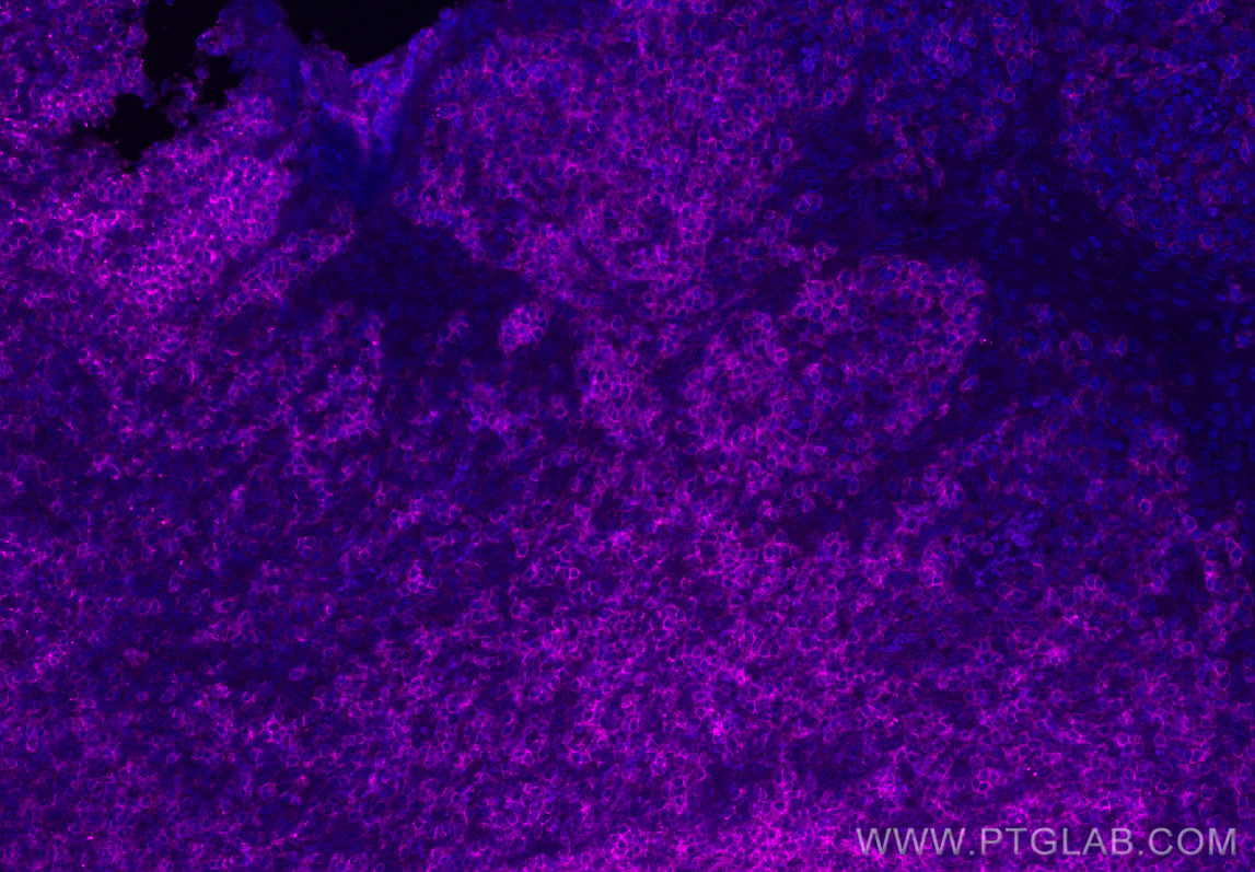 Immunofluorescence (IF) / fluorescent staining of human tonsillitis tissue using APC Anti-Human CD45RA (HI100) (APC-65108)