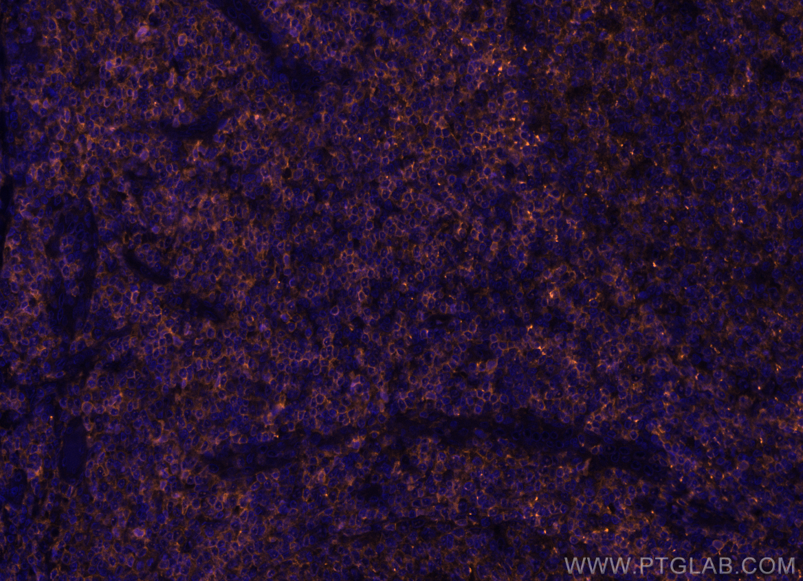 Immunofluorescence (IF) / fluorescent staining of human tonsillitis tissue using PE Anti-Human CD45RA (HI100) (PE-65108)