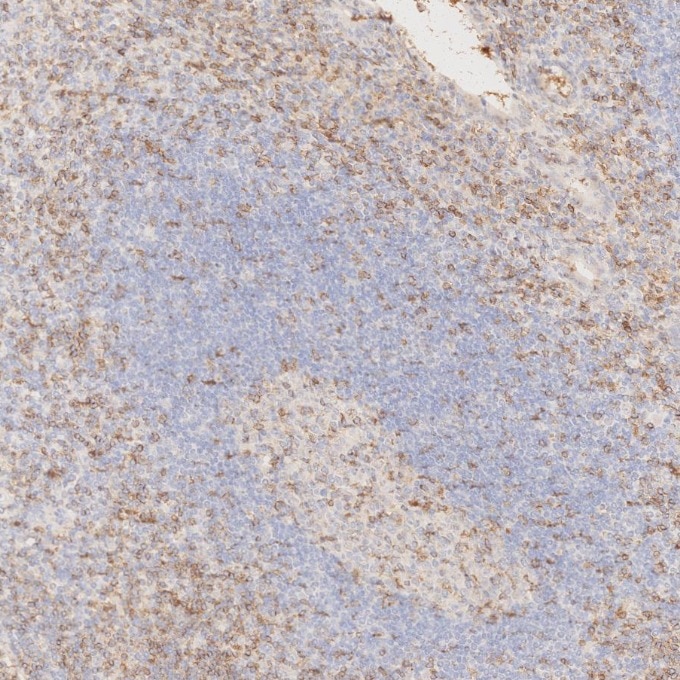 Immunohistochemistry (IHC) staining of human appendicitis tissue using Anti-Human CD45RO (UCHL1) (65150-1-Ig)