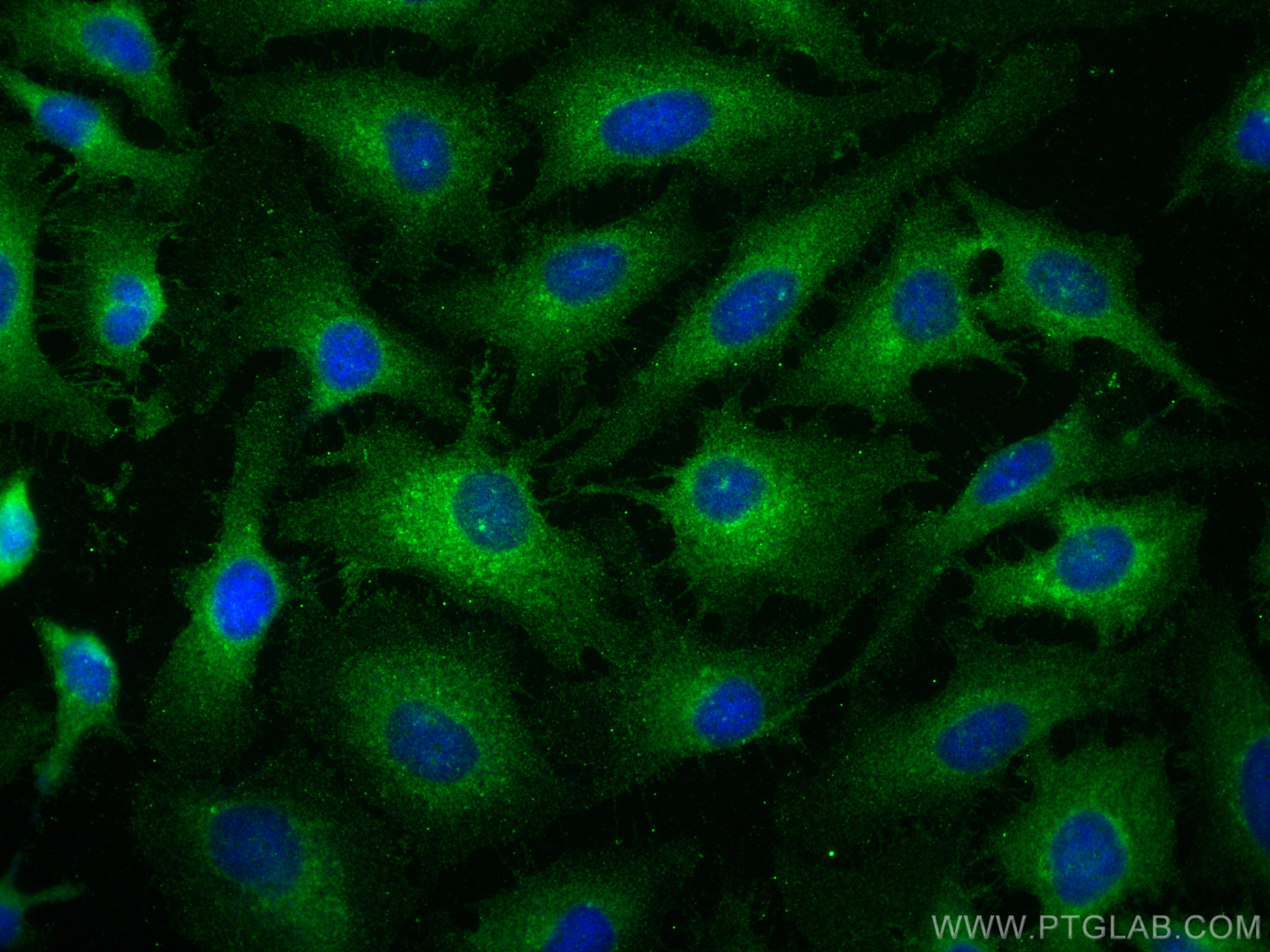 Immunofluorescence (IF) / fluorescent staining of HeLa cells using CD46 Polyclonal antibody (28936-1-AP)