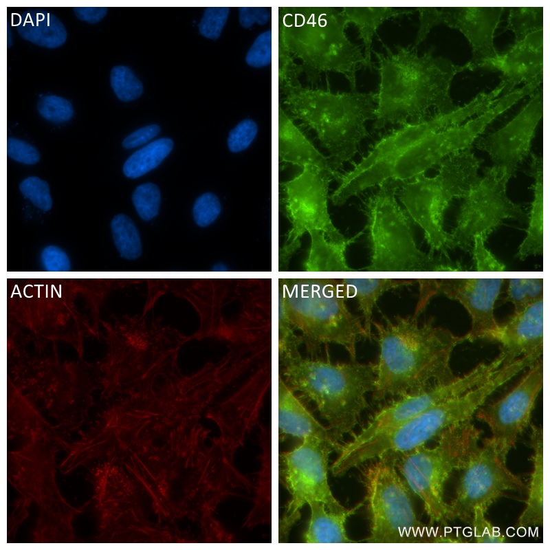 Immunofluorescence (IF) / fluorescent staining of HeLa cells using CD46 Recombinant antibody (84599-5-RR)