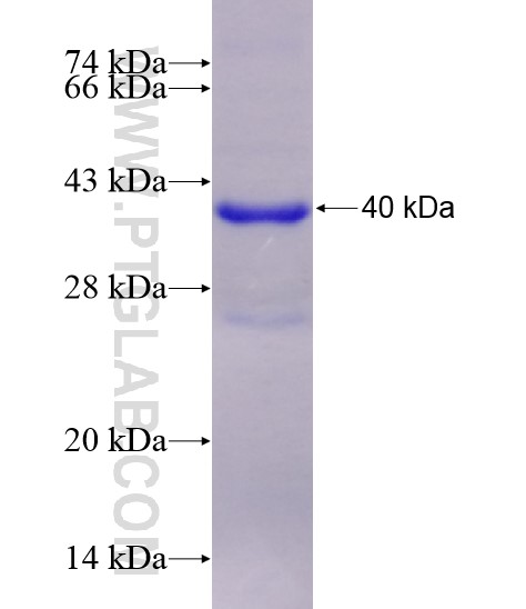 CD46 fusion protein Ag28581 SDS-PAGE