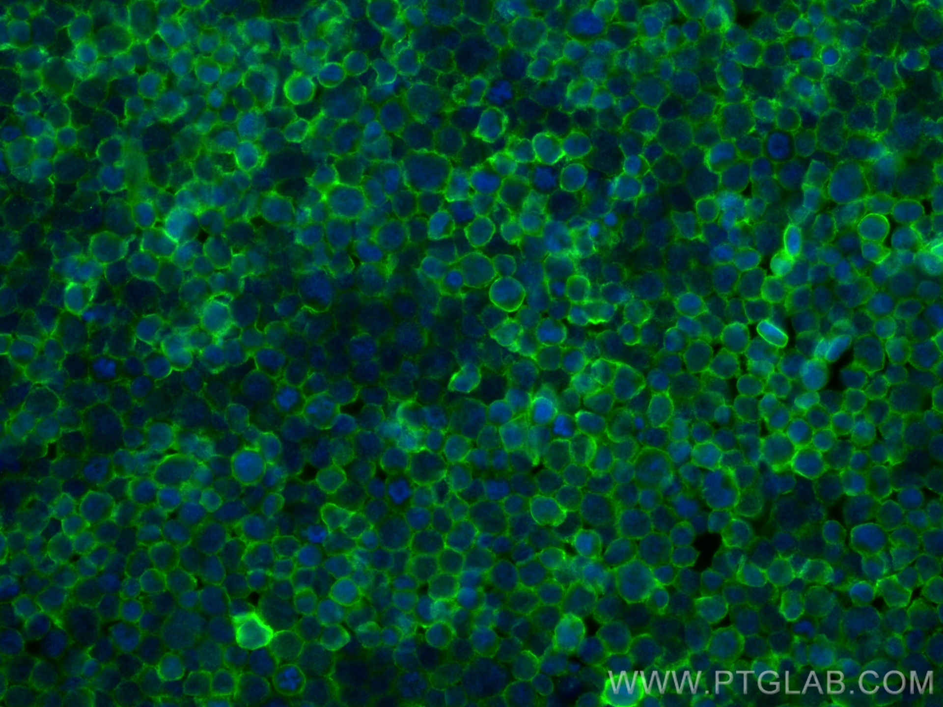 Immunofluorescence (IF) / fluorescent staining of Jurkat cells using CD47 Monoclonal antibody (60551-1-Ig)
