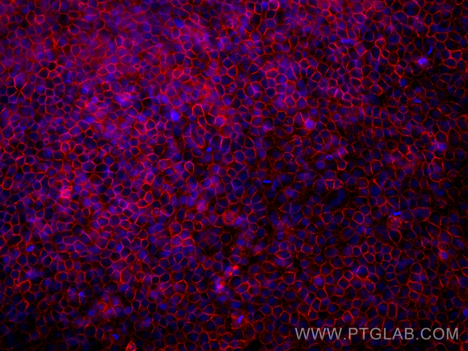 Immunofluorescence (IF) / fluorescent staining of HepG2 cells using CD47 Monoclonal antibody (60551-1-Ig)