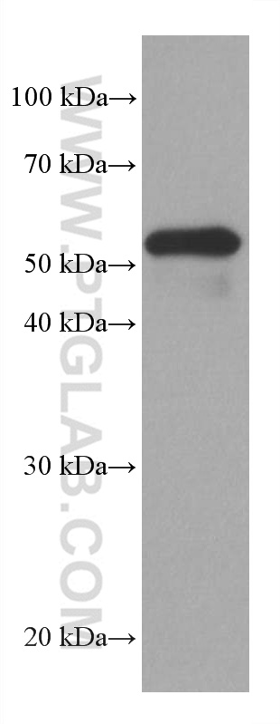 Western Blot (WB) analysis of human placenta tissue using CD47 Monoclonal antibody (66304-1-Ig)